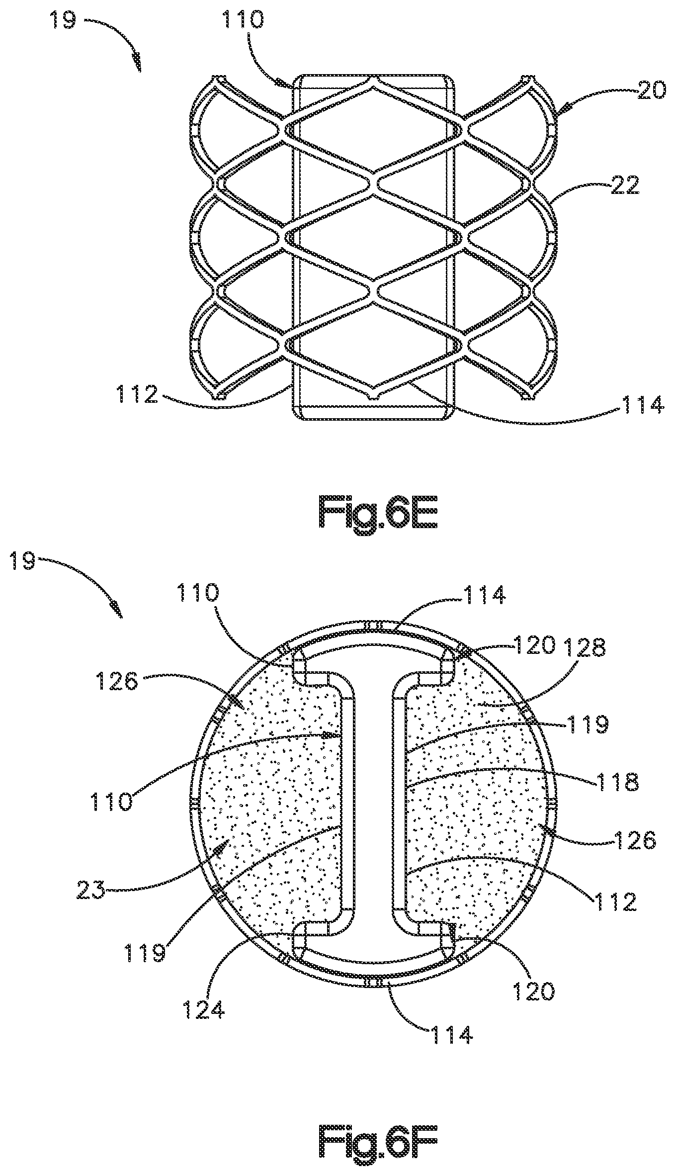 Patent US12350166 Figure 18 – Method and apparatus for augmenting bone