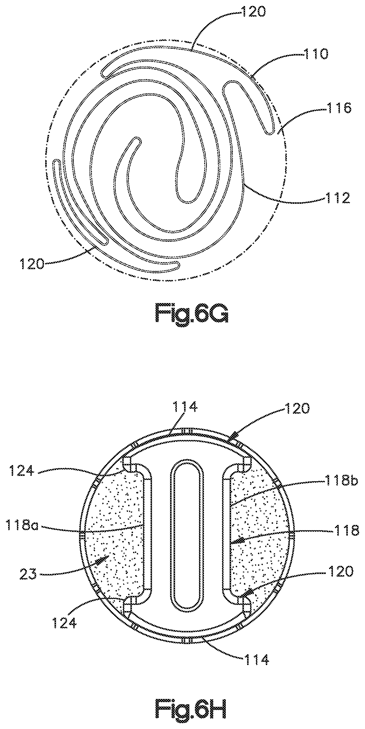 Patent US12350166 Figure 19 – Method and apparatus for augmenting bone