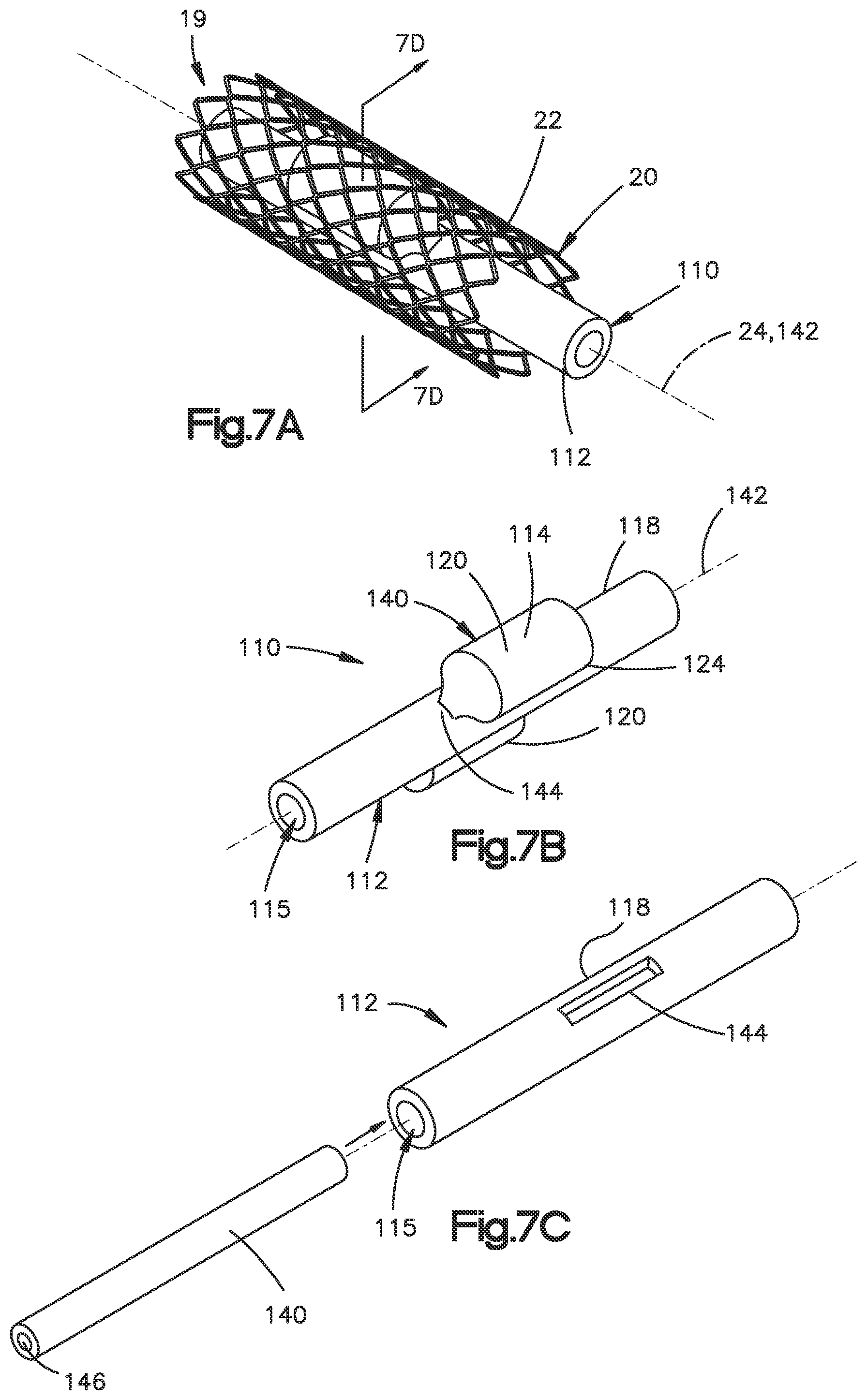 Patent US12350166 Figure 20 – Method and apparatus for augmenting bone