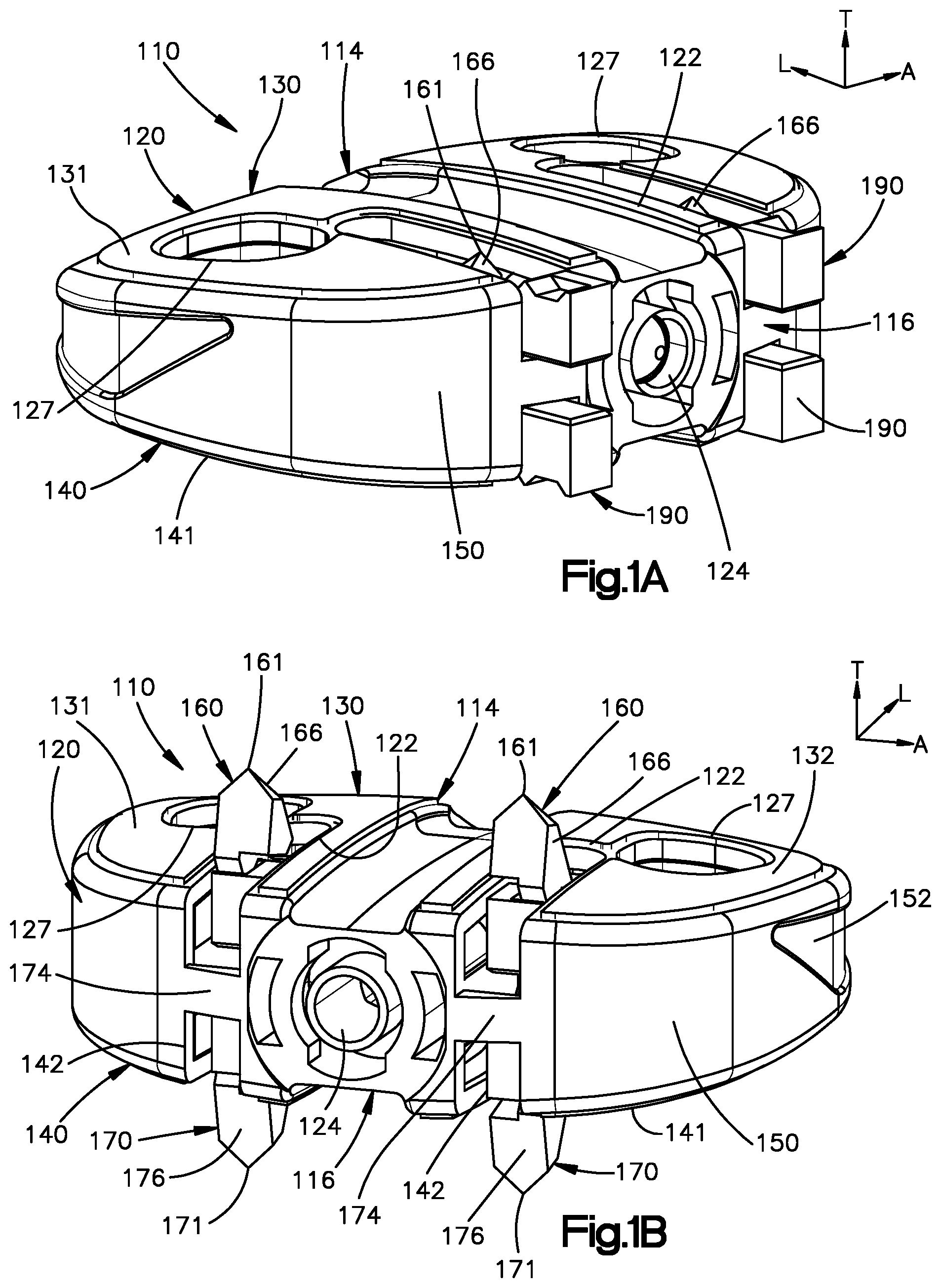 Patent US12350167 — Intervertebral cages with deployable anchors — Figure 1