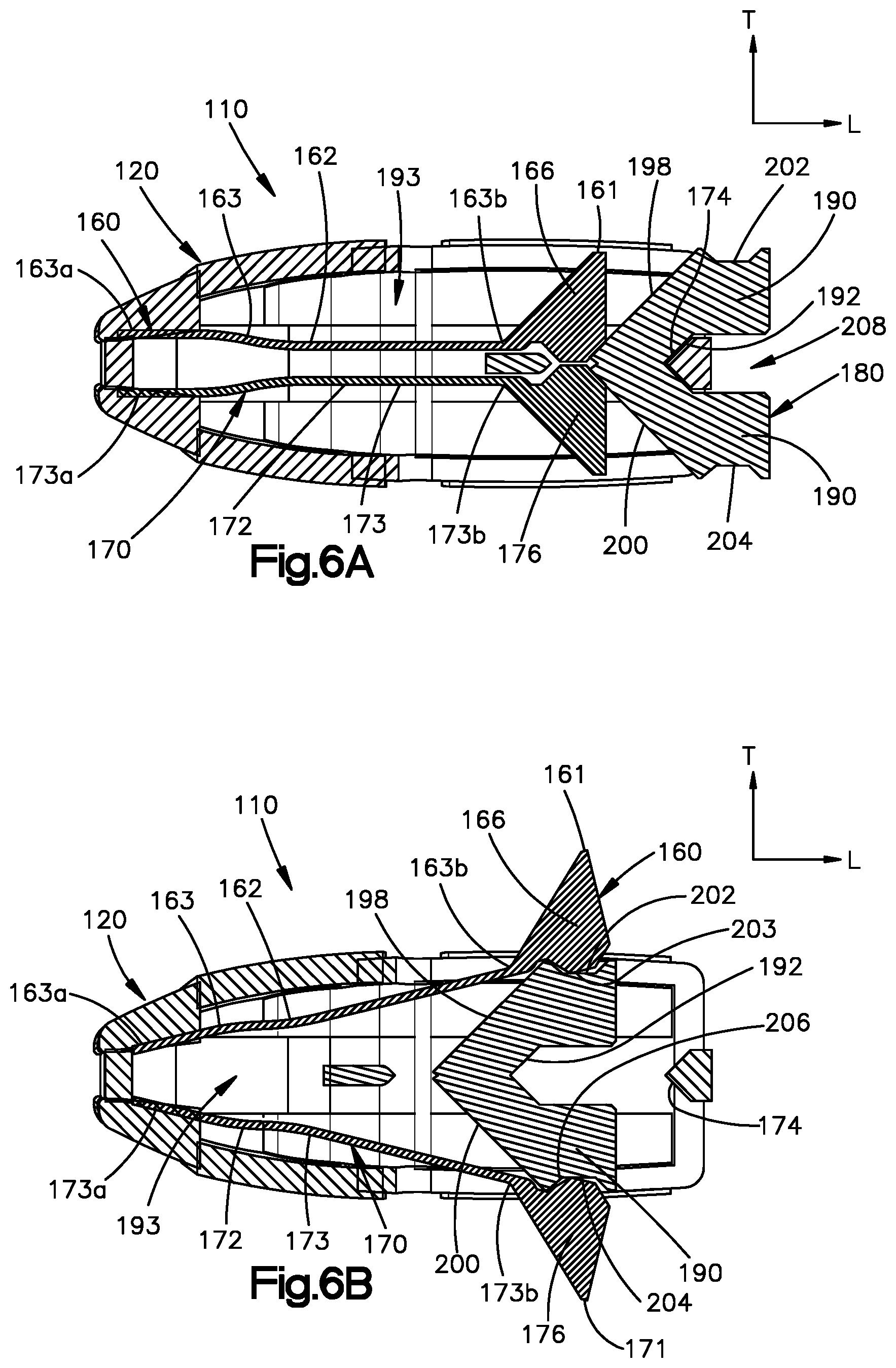 Patent US12350167 Figure 5 – Intervertebral cages with deployable anchors