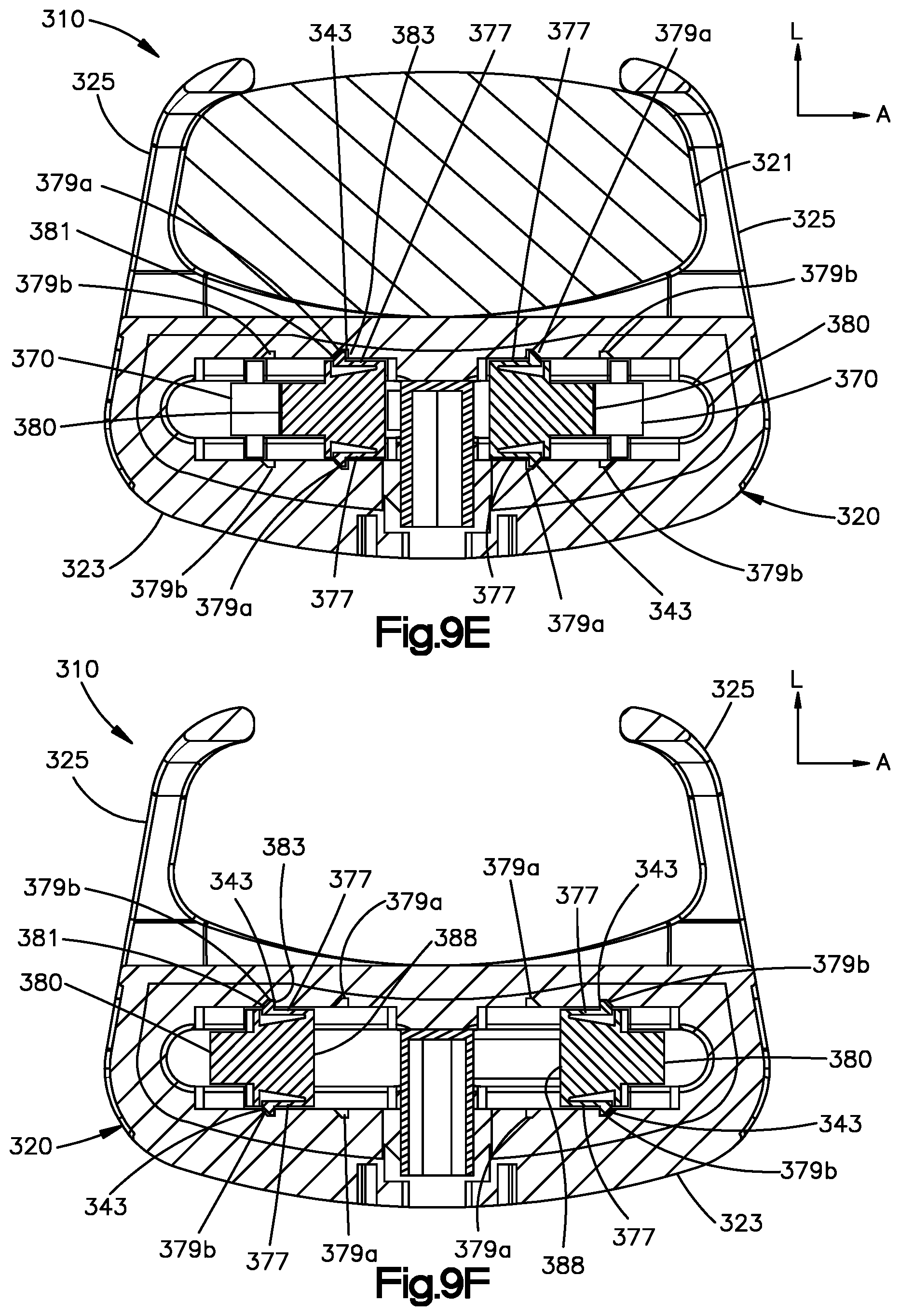 Patent US12350167 Figure 11 – Intervertebral cages with deployable anchors