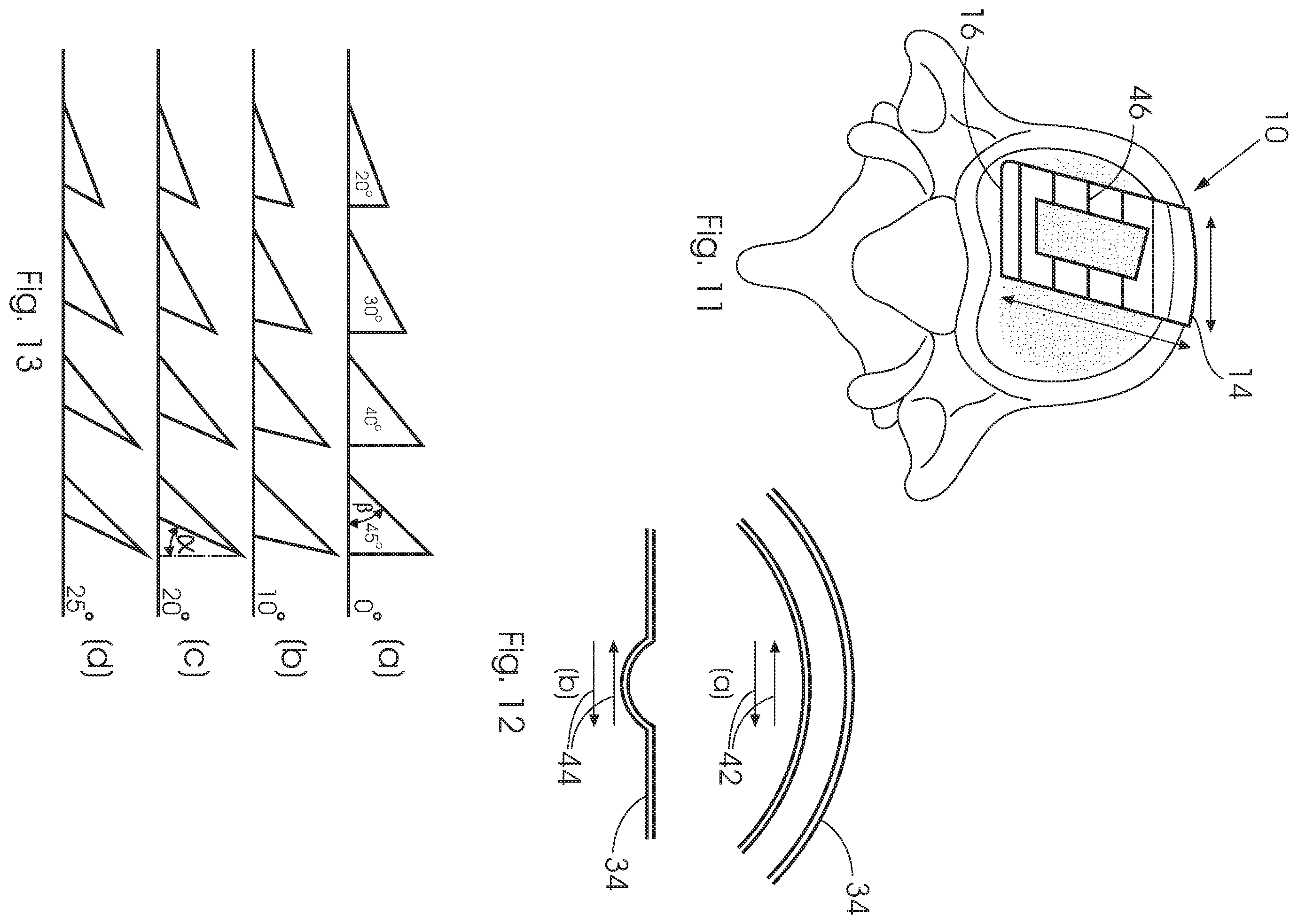 Patent US12350168 Figure 7 – Intervertebral fusion cage