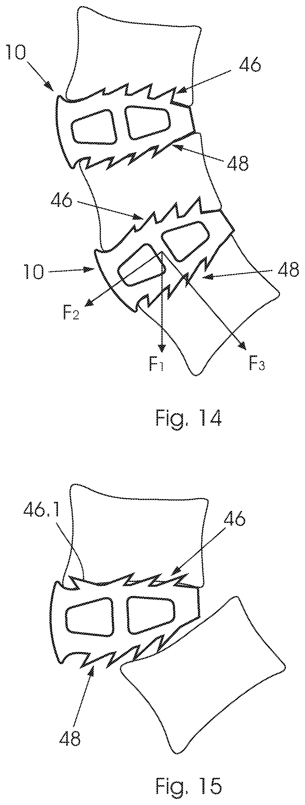 Patent US12350168 Figure 8 – Intervertebral fusion cage