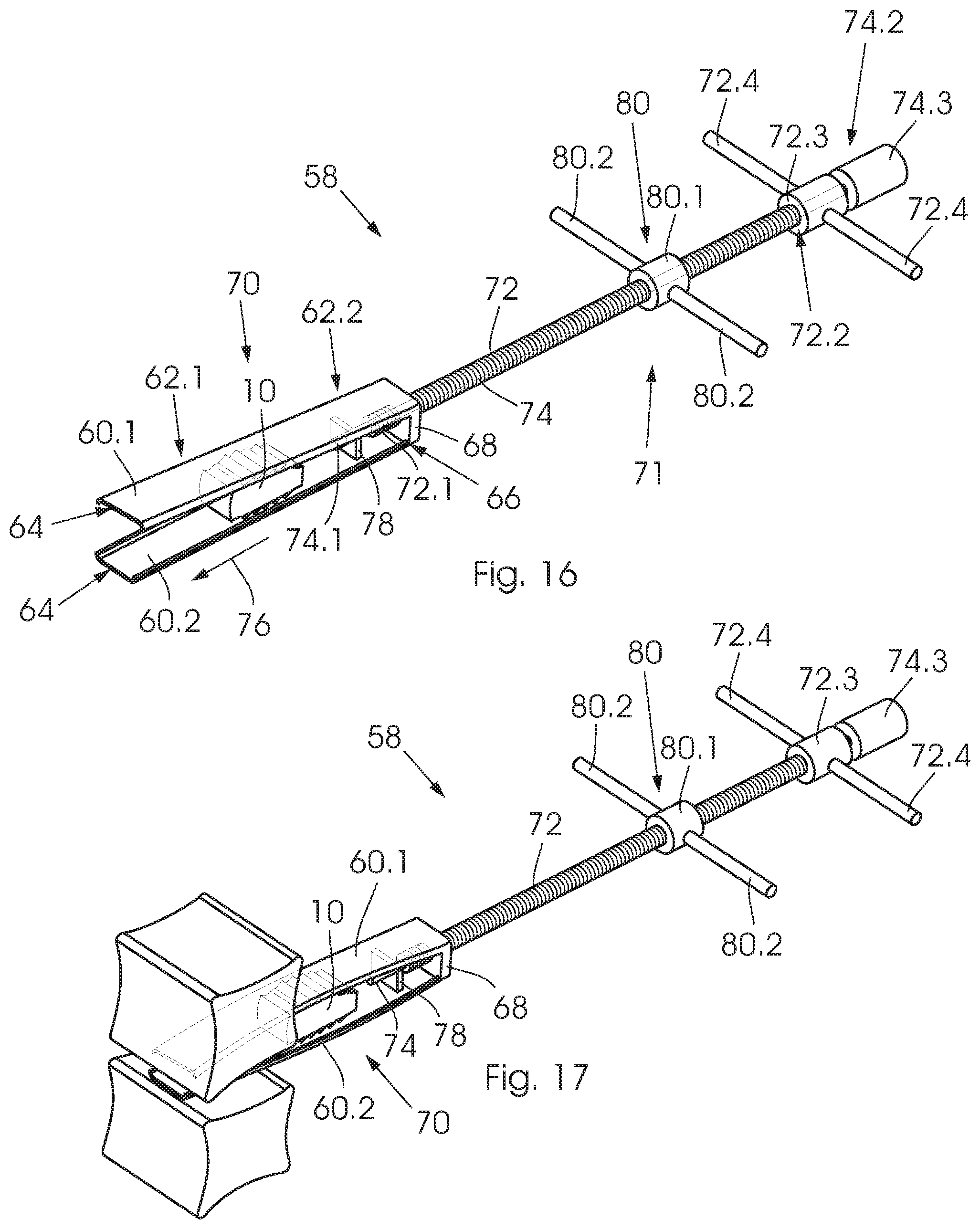 Patent US12350168 Figure 9 – Intervertebral fusion cage