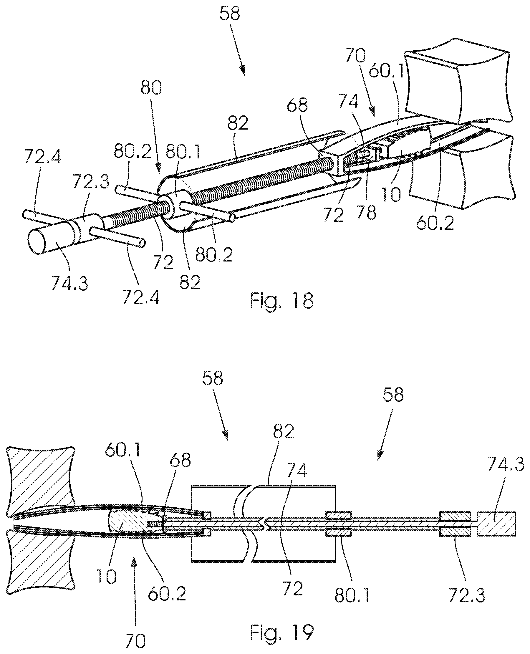 Patent US12350168 Figure 10 – Intervertebral fusion cage