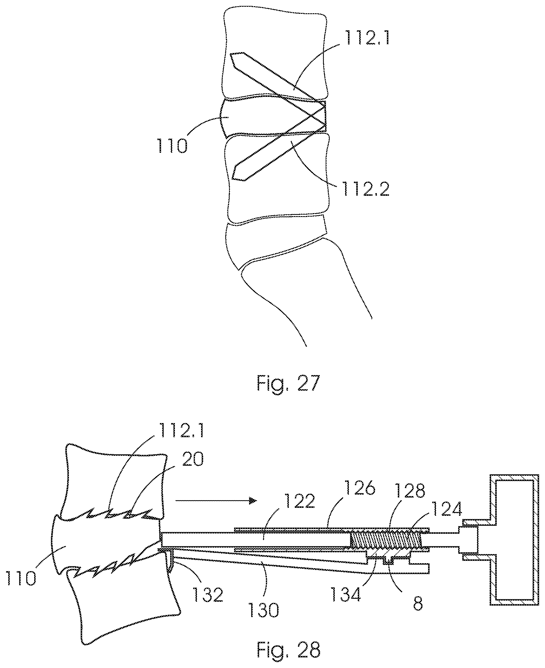 Patent US12350168 Figure 14 – Intervertebral fusion cage