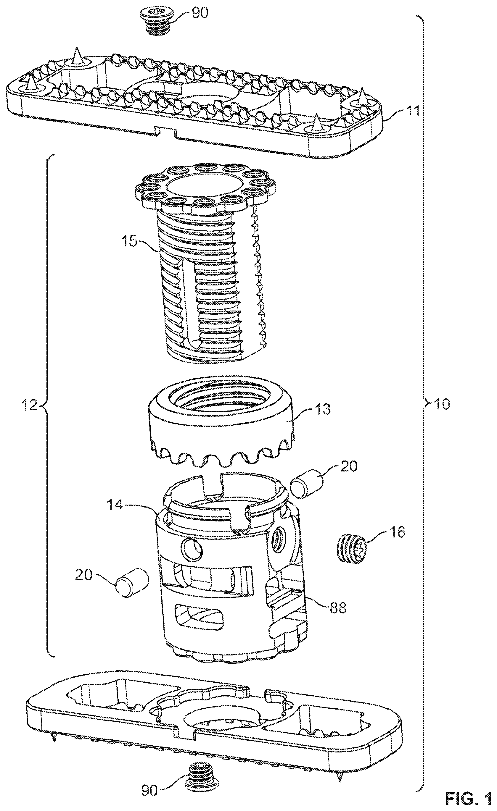 Patent US12350169 Figure 1 – Vertebral body replacement