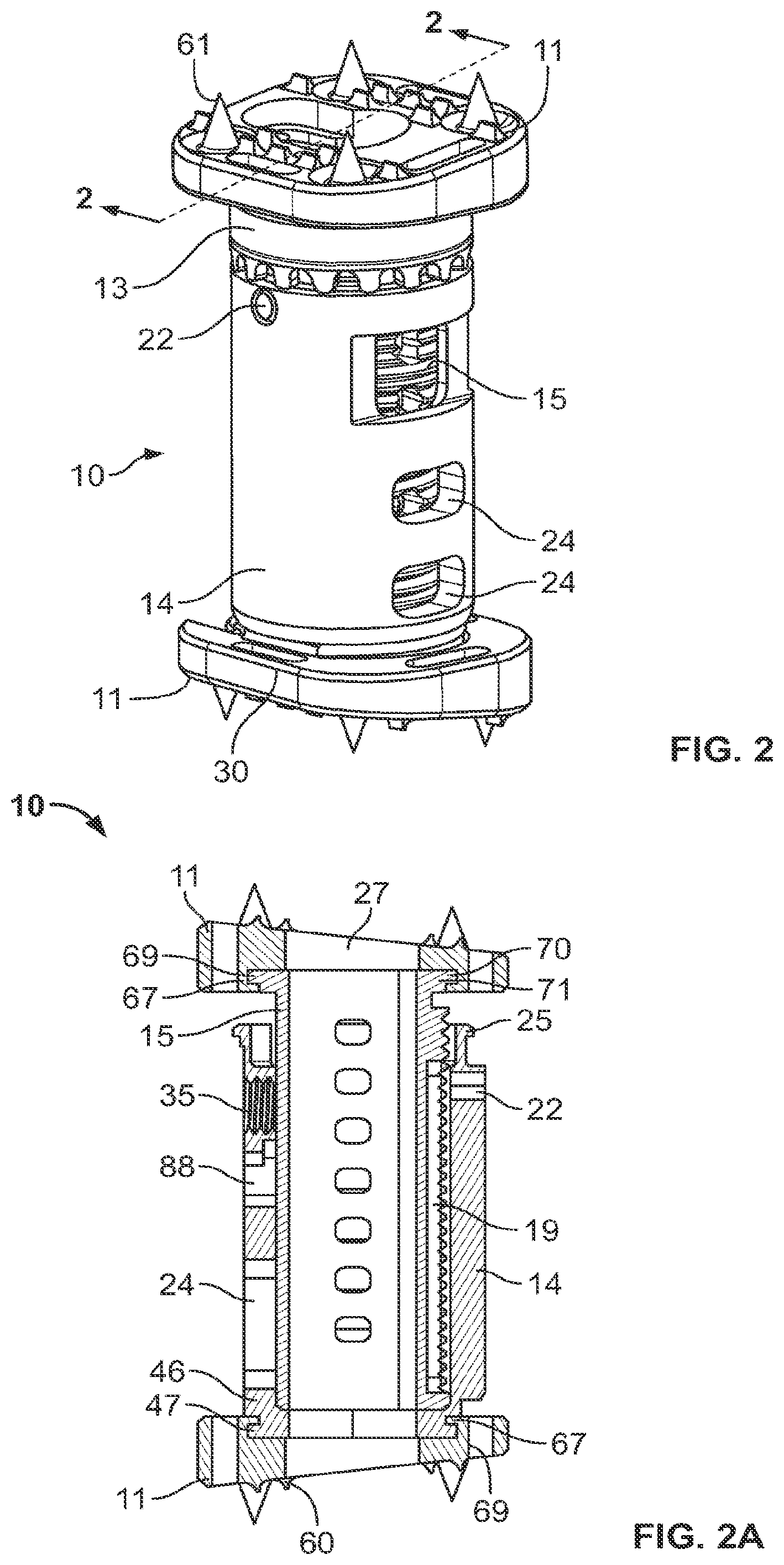 Patent US12350169 Figure 2 – Vertebral body replacement