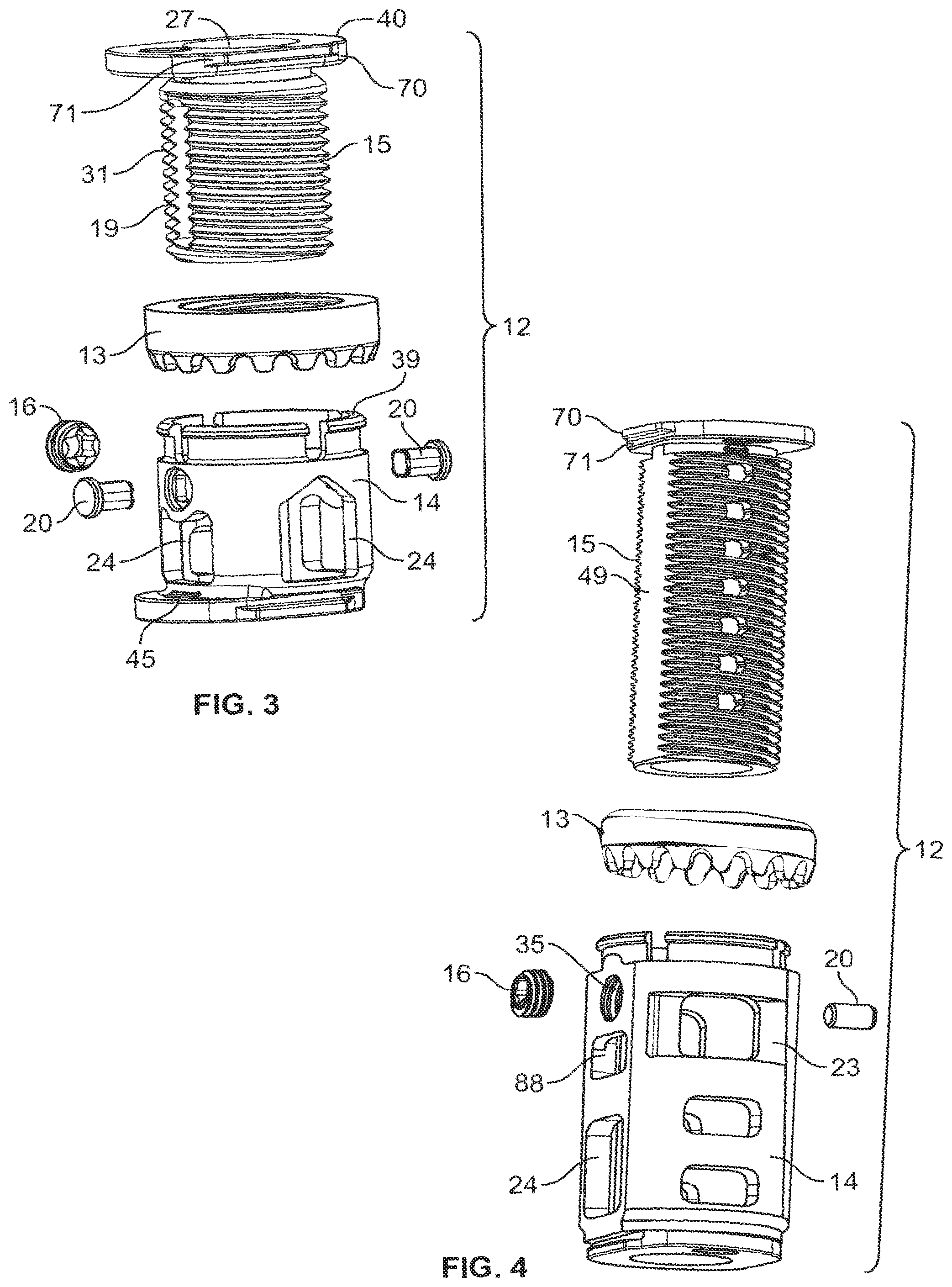 Patent US12350169 Figure 3 – Vertebral body replacement
