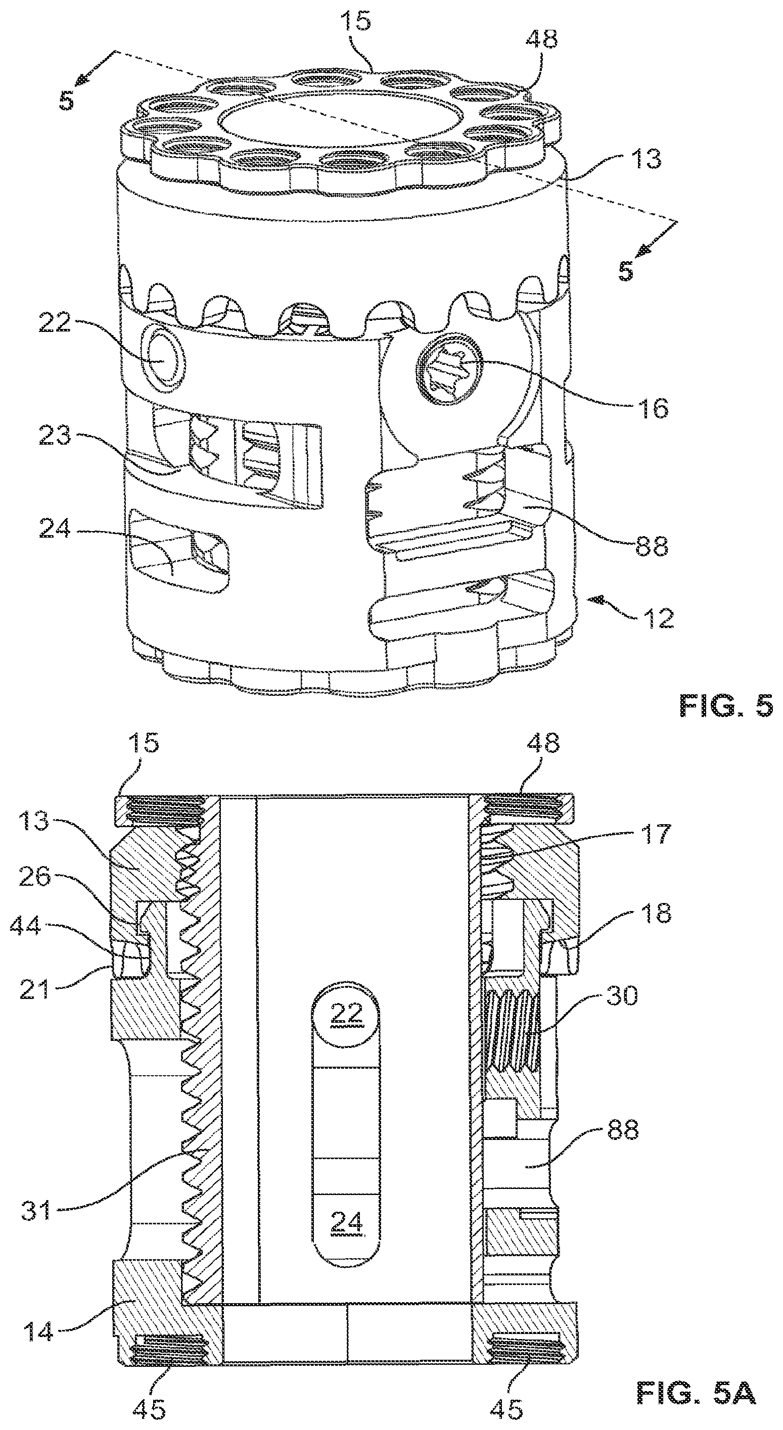 Patent US12350169 Figure 4 – Vertebral body replacement