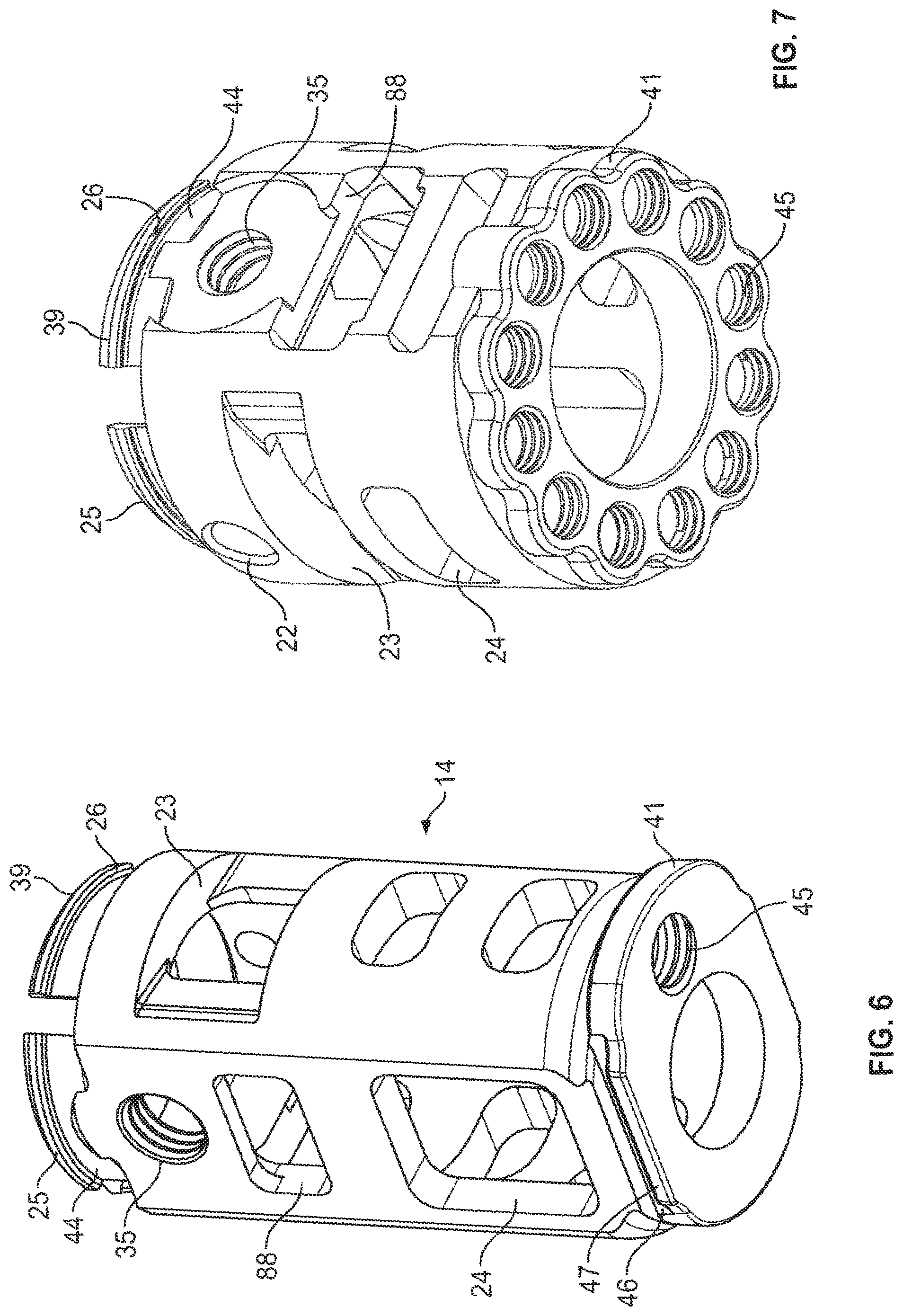 Patent US12350169 Figure 5 – Vertebral body replacement