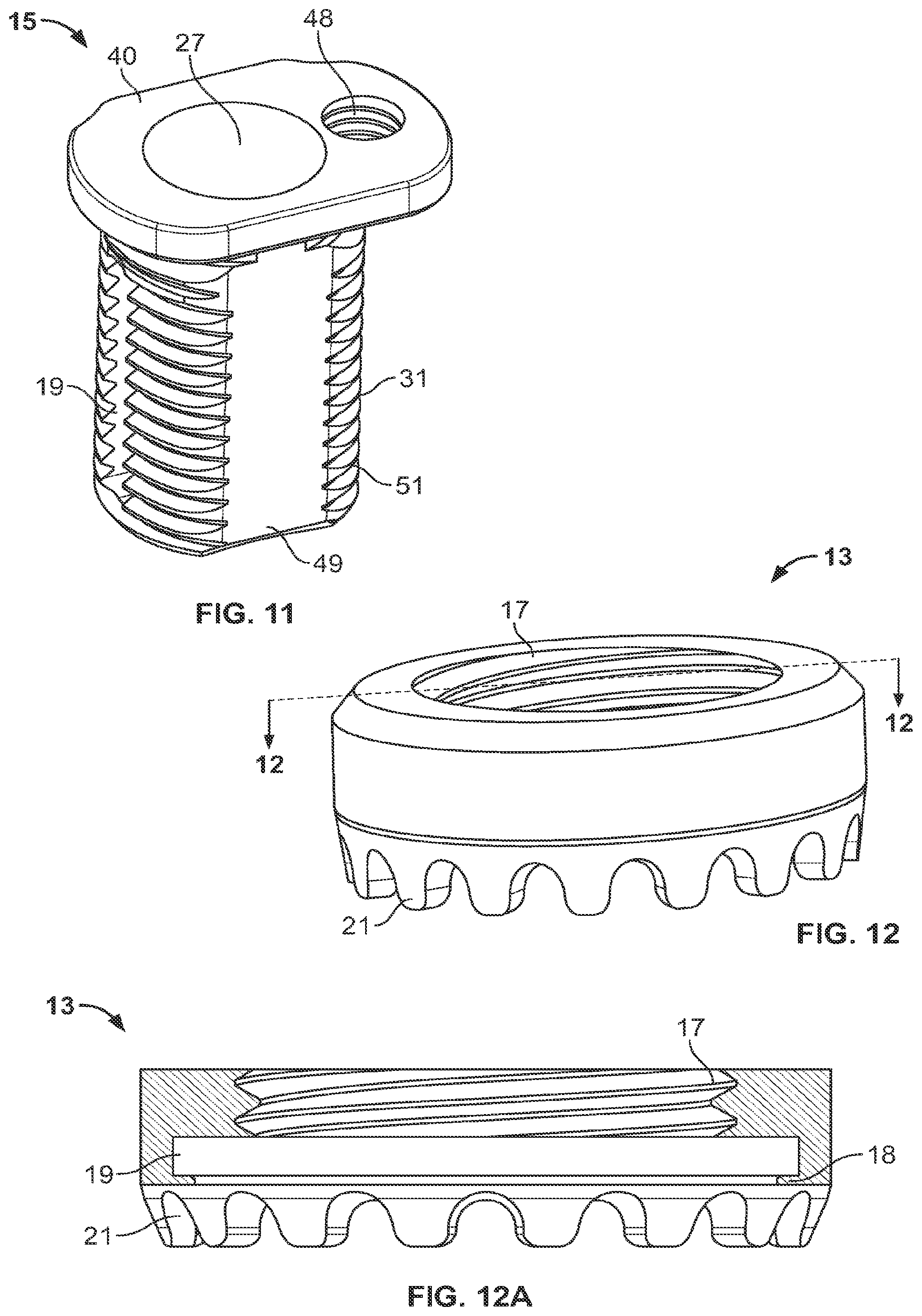 Patent US12350169 Figure 7 – Vertebral body replacement