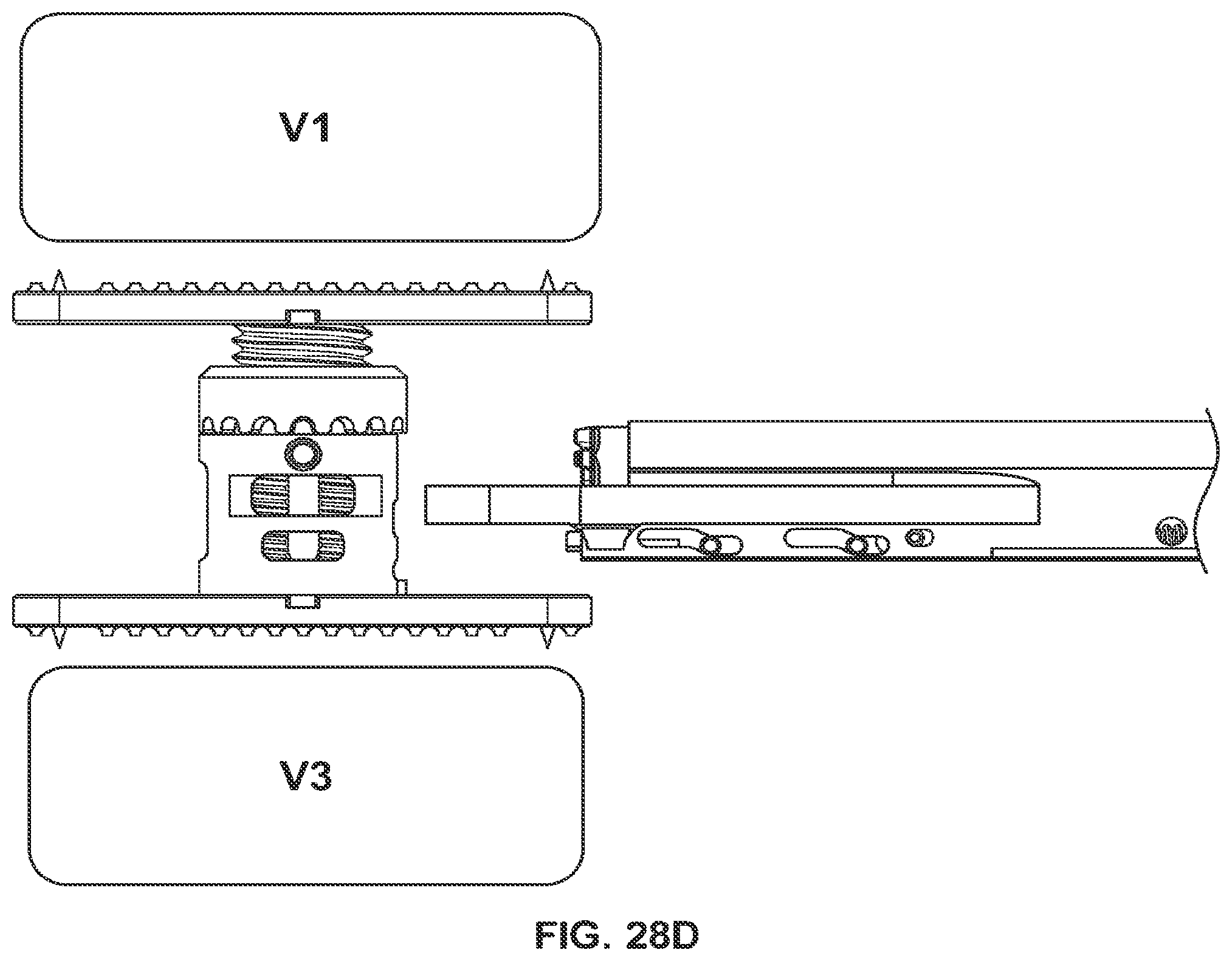 Patent US12350169 Figure 16 – Vertebral body replacement
