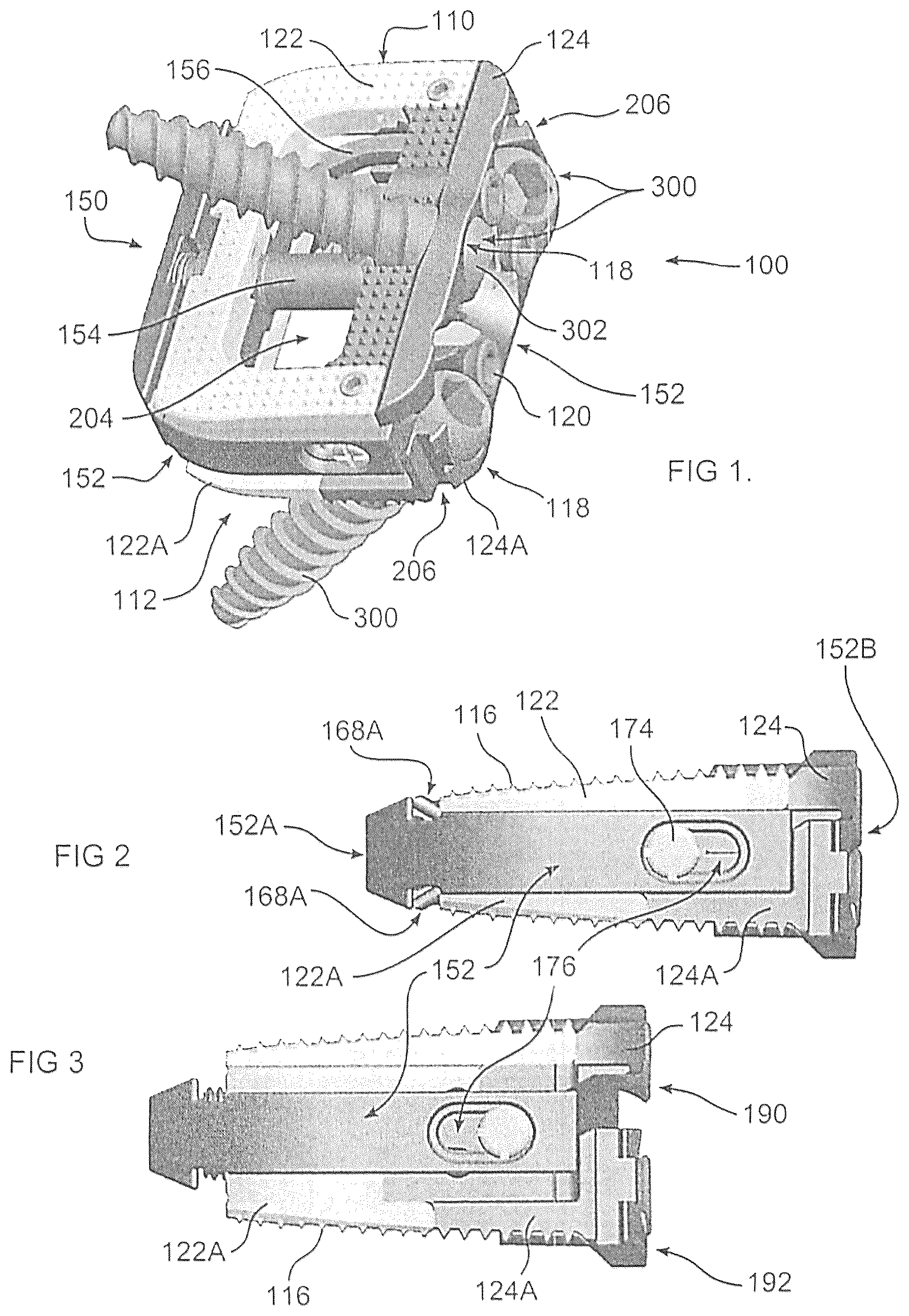 Patent US12350170 Figure 1 – Expandable intervertebral implant