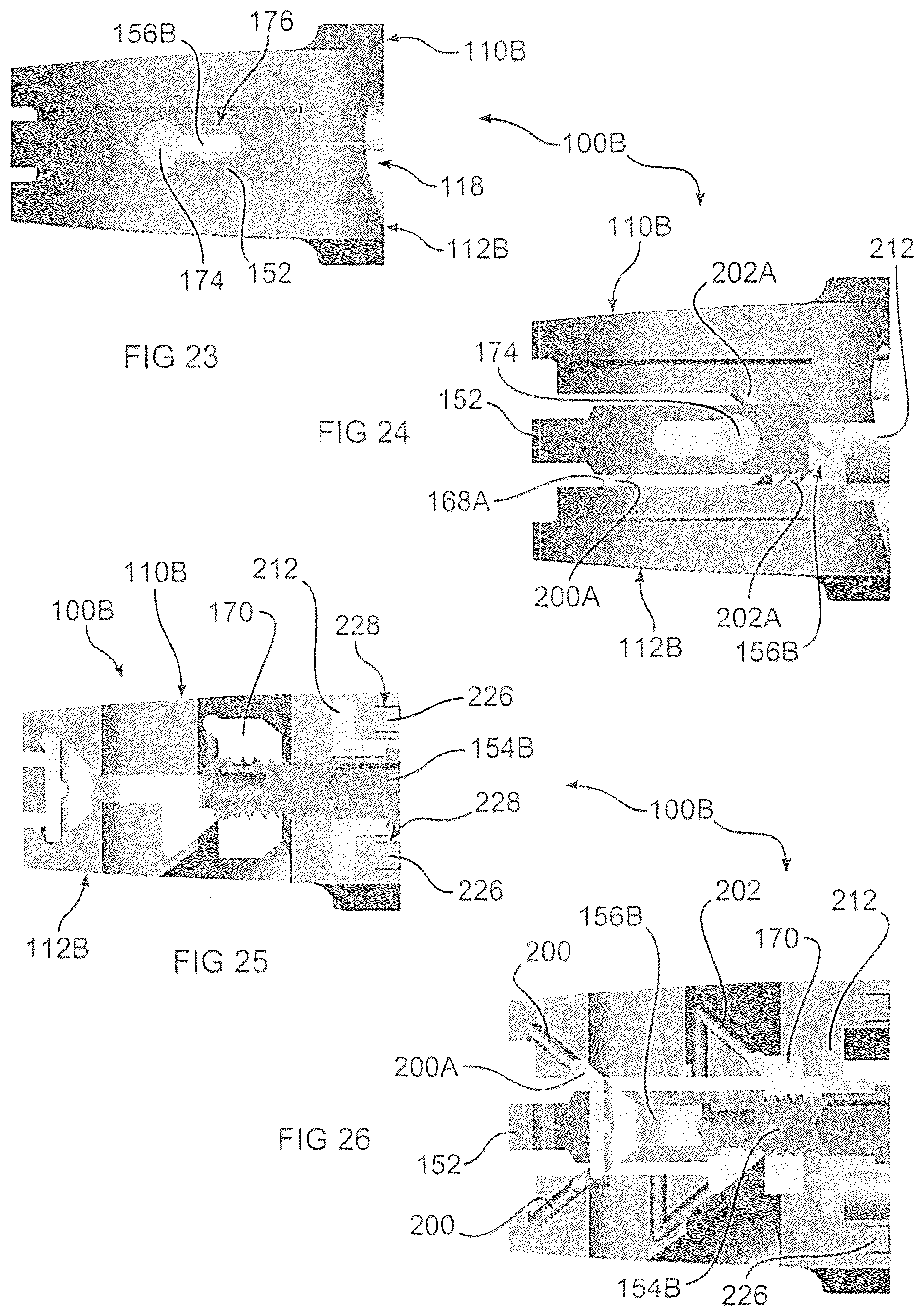 Patent US12350170 Figure 7 – Expandable intervertebral implant