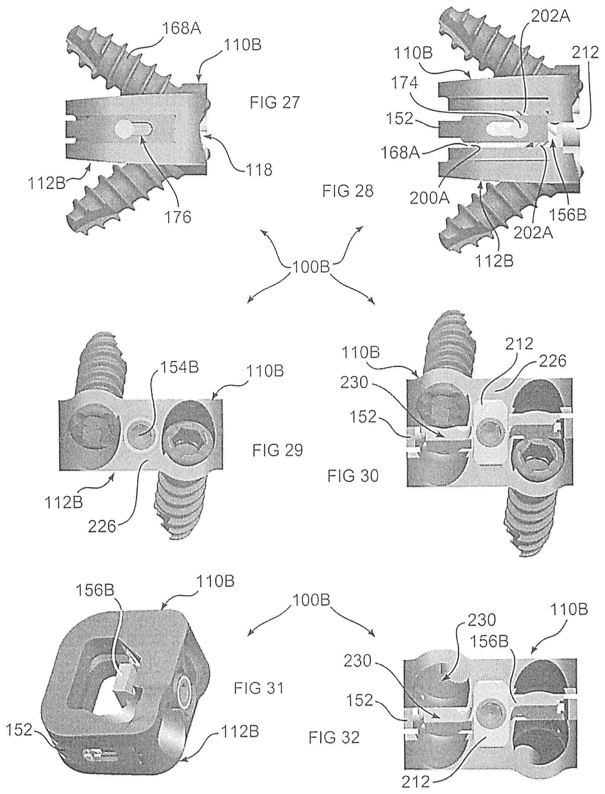 Patent US12350170 Figure 8 – Expandable intervertebral implant