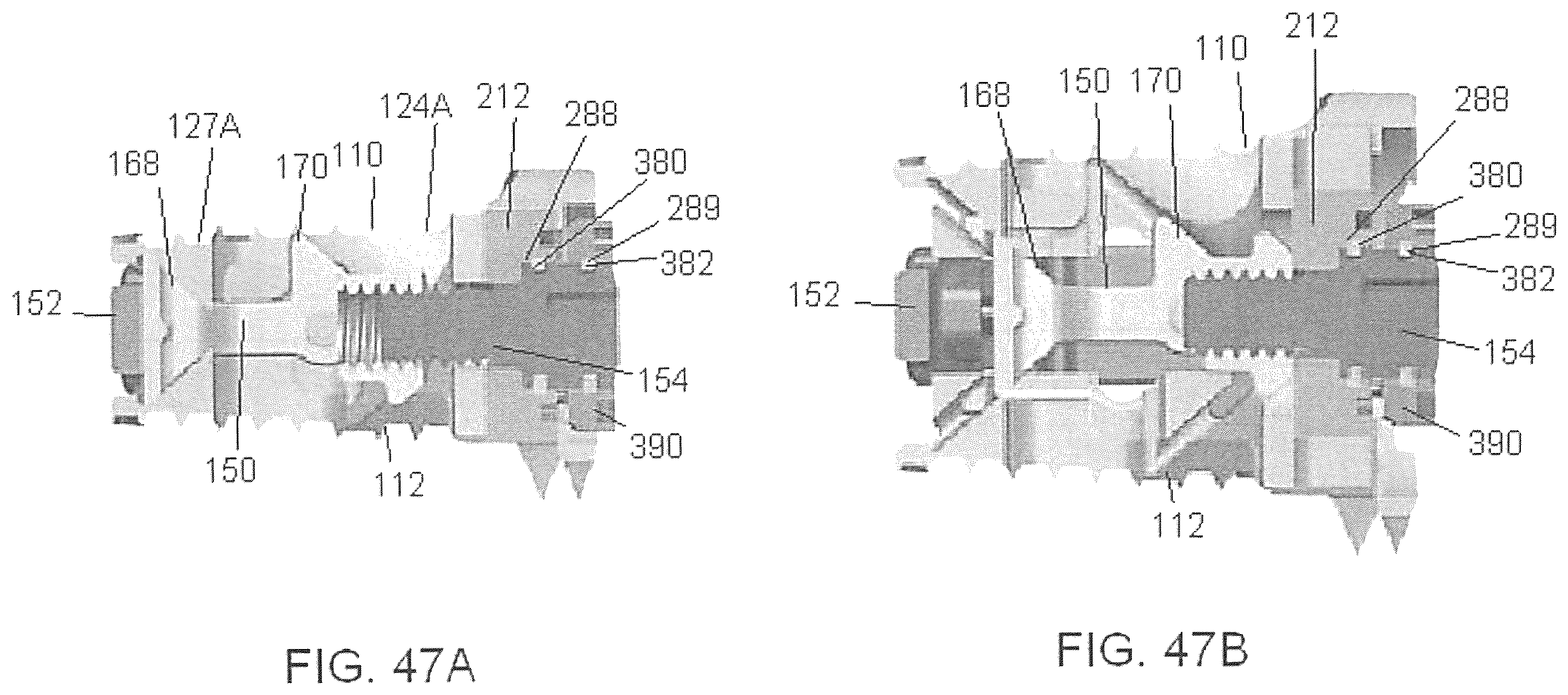 Patent US12350170 Figure 13 – Expandable intervertebral implant