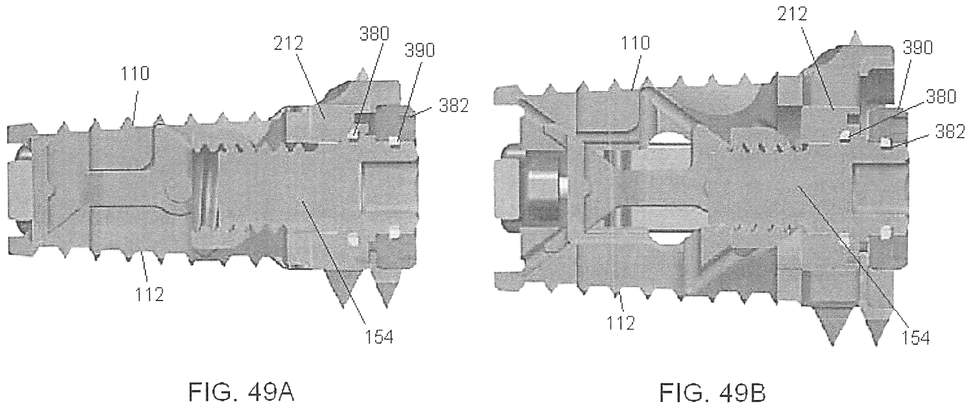 Patent US12350170 Figure 15 – Expandable intervertebral implant