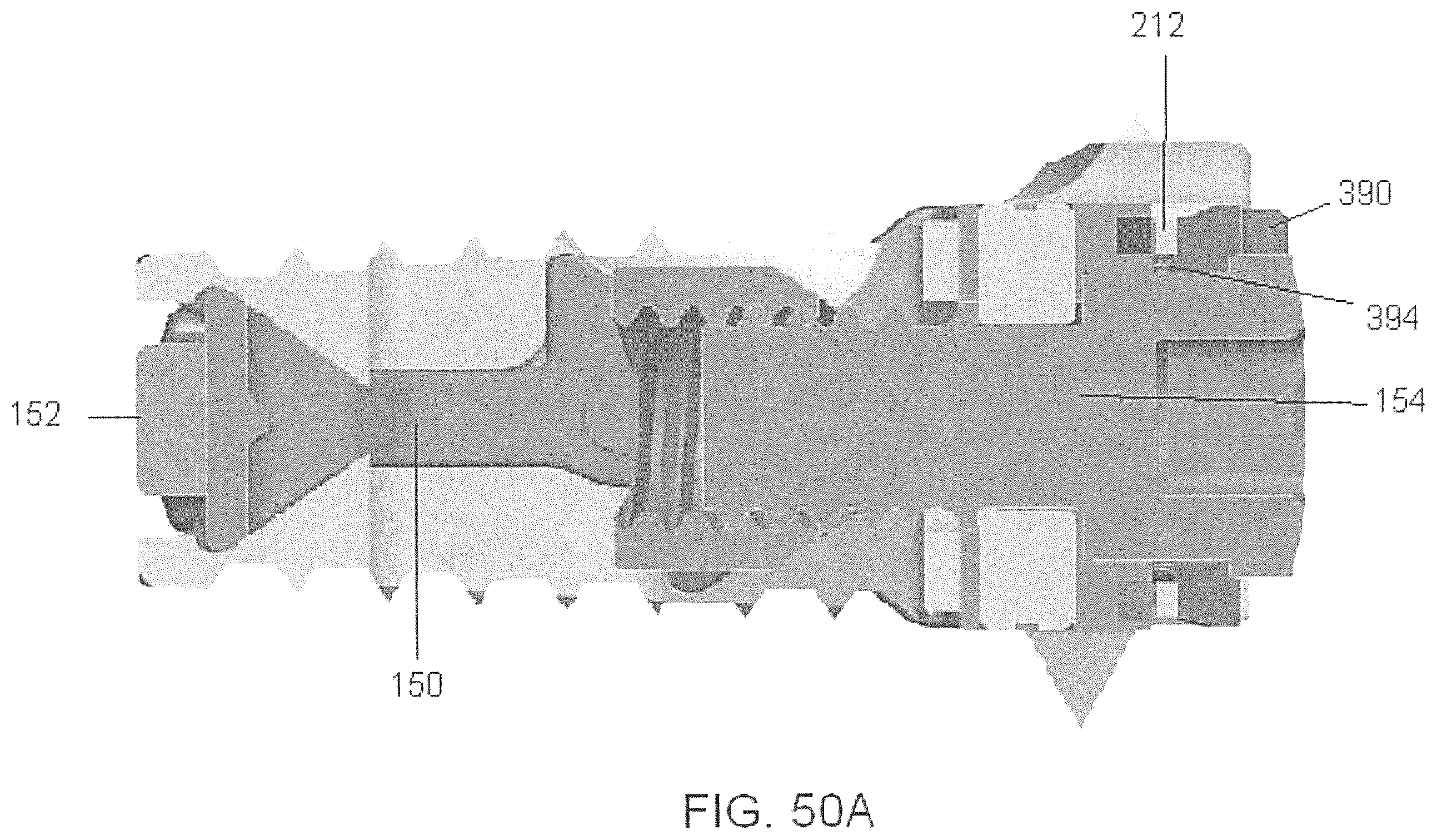 Patent US12350170 Figure 16 – Expandable intervertebral implant