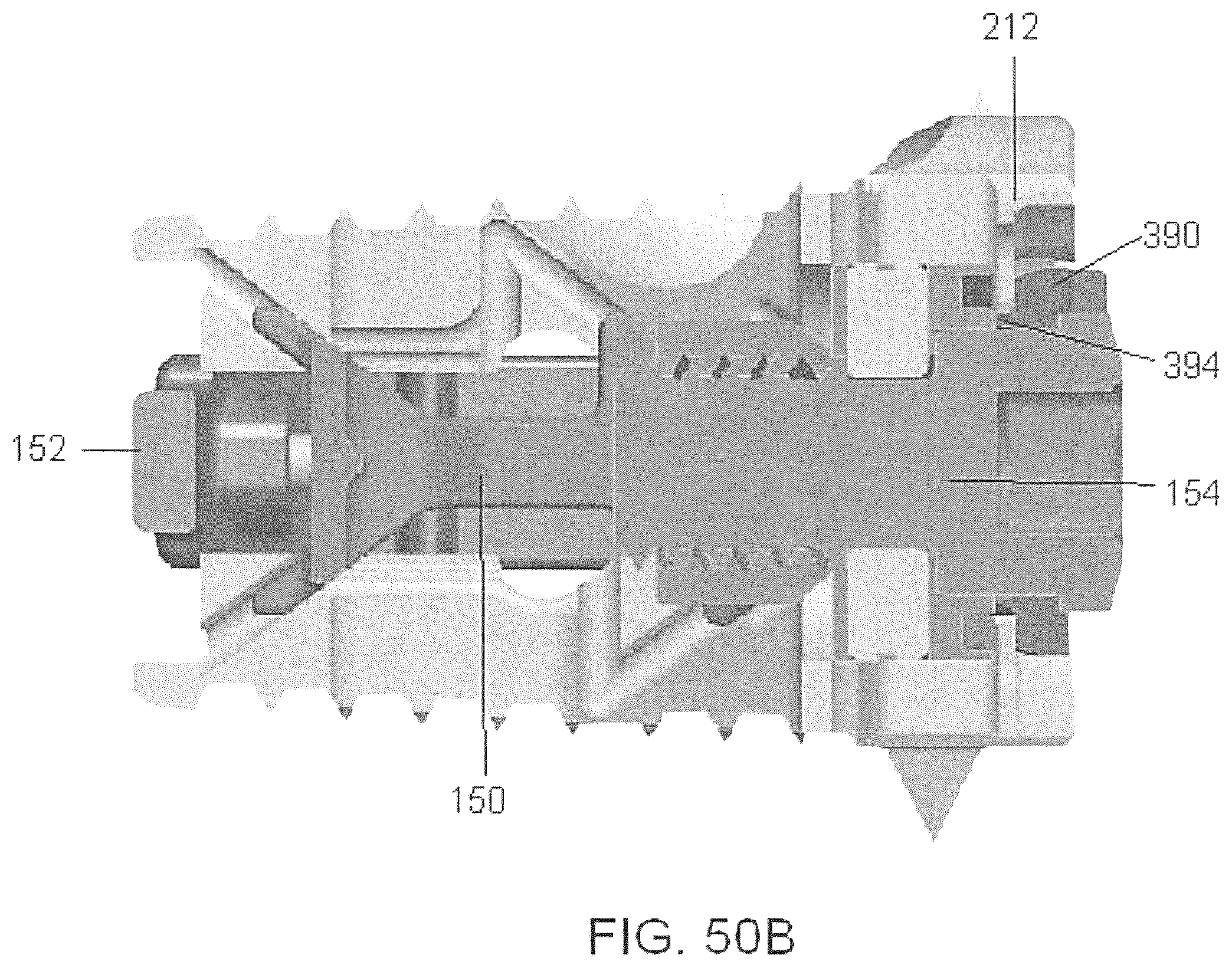 Patent US12350170 Figure 17 – Expandable intervertebral implant