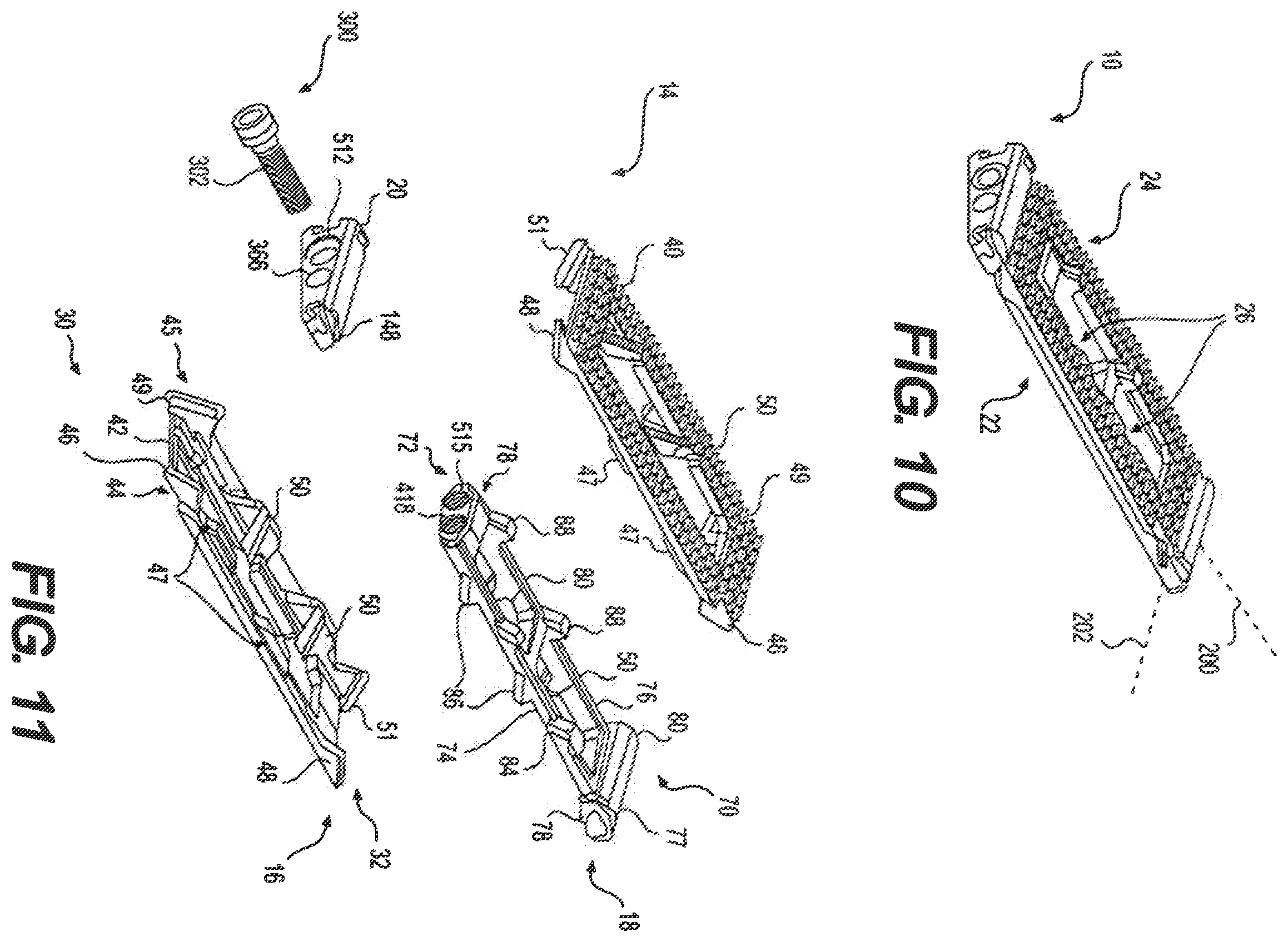 Patent US12350171 Figure 5 – Variable lordosis spacer and related methods of use