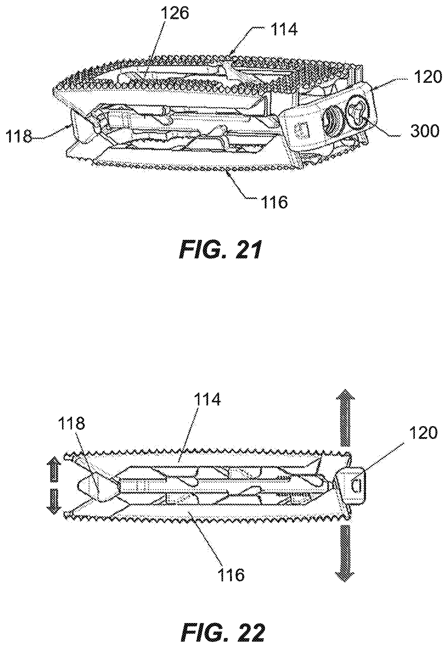 Patent US12350171 Figure 10 – Variable lordosis spacer and related methods of use
