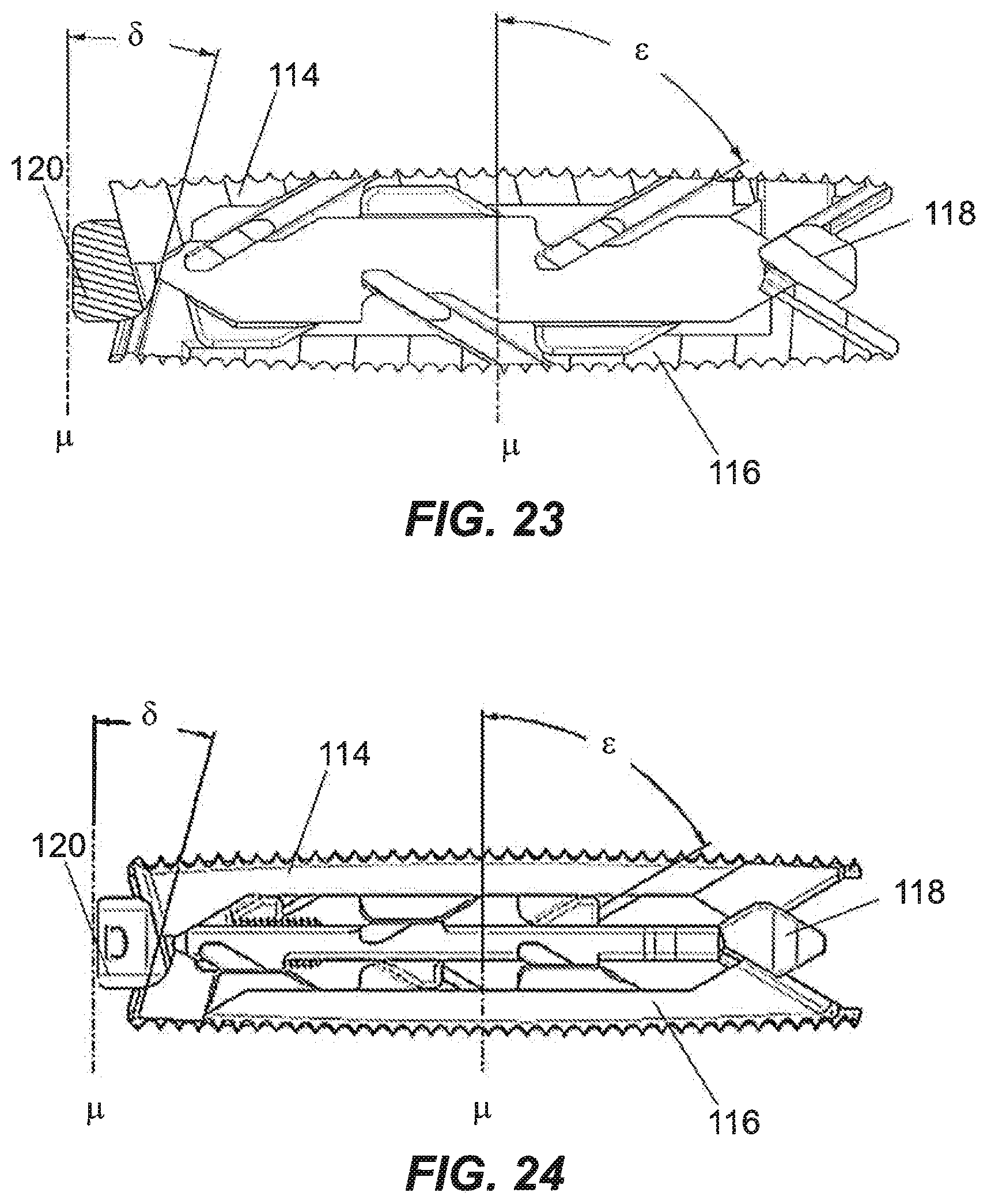 Patent US12350171 Figure 11 – Variable lordosis spacer and related methods of use