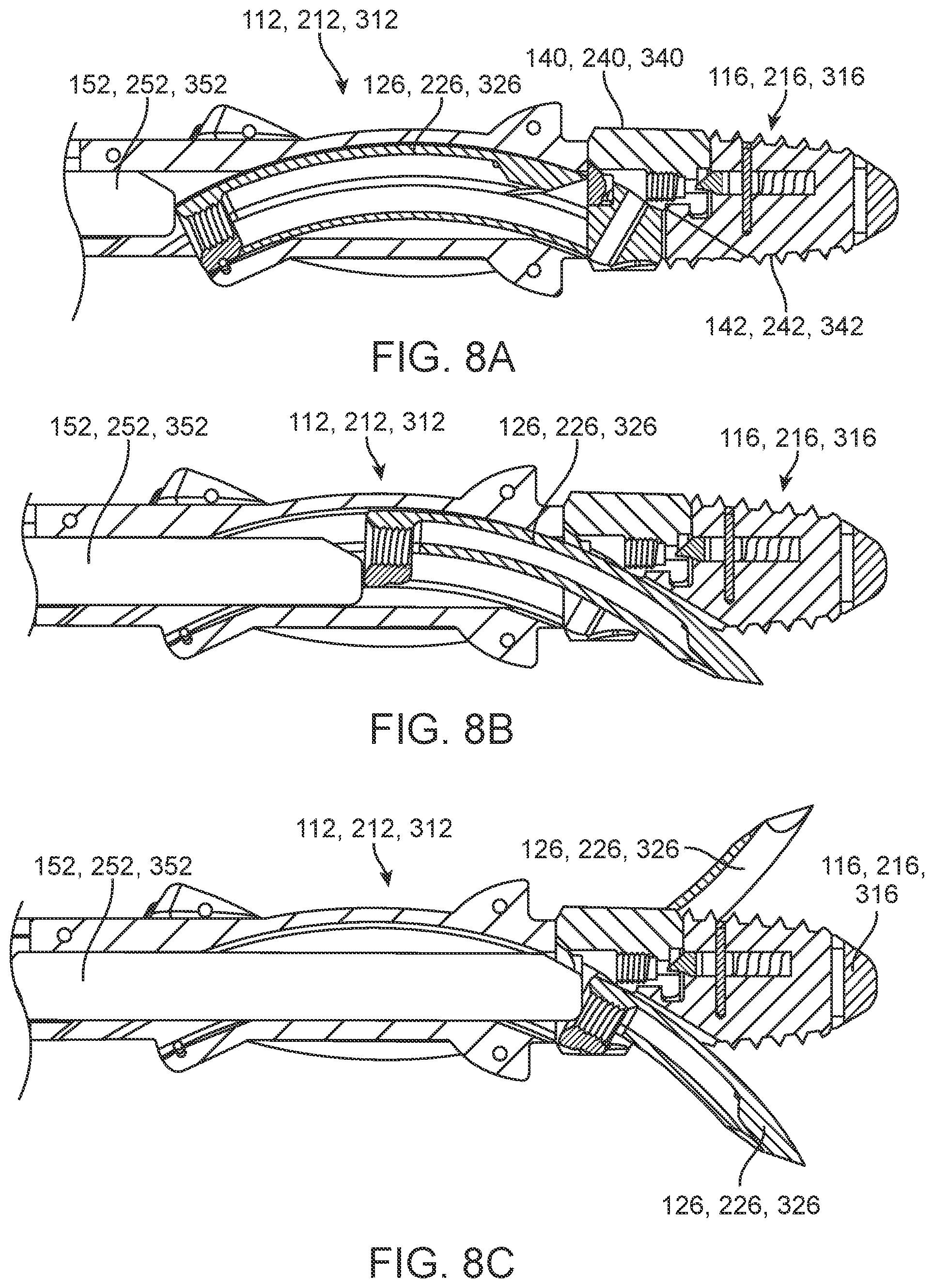 Patent US12350174 Figure 6 – Fixation member inserter instrument
