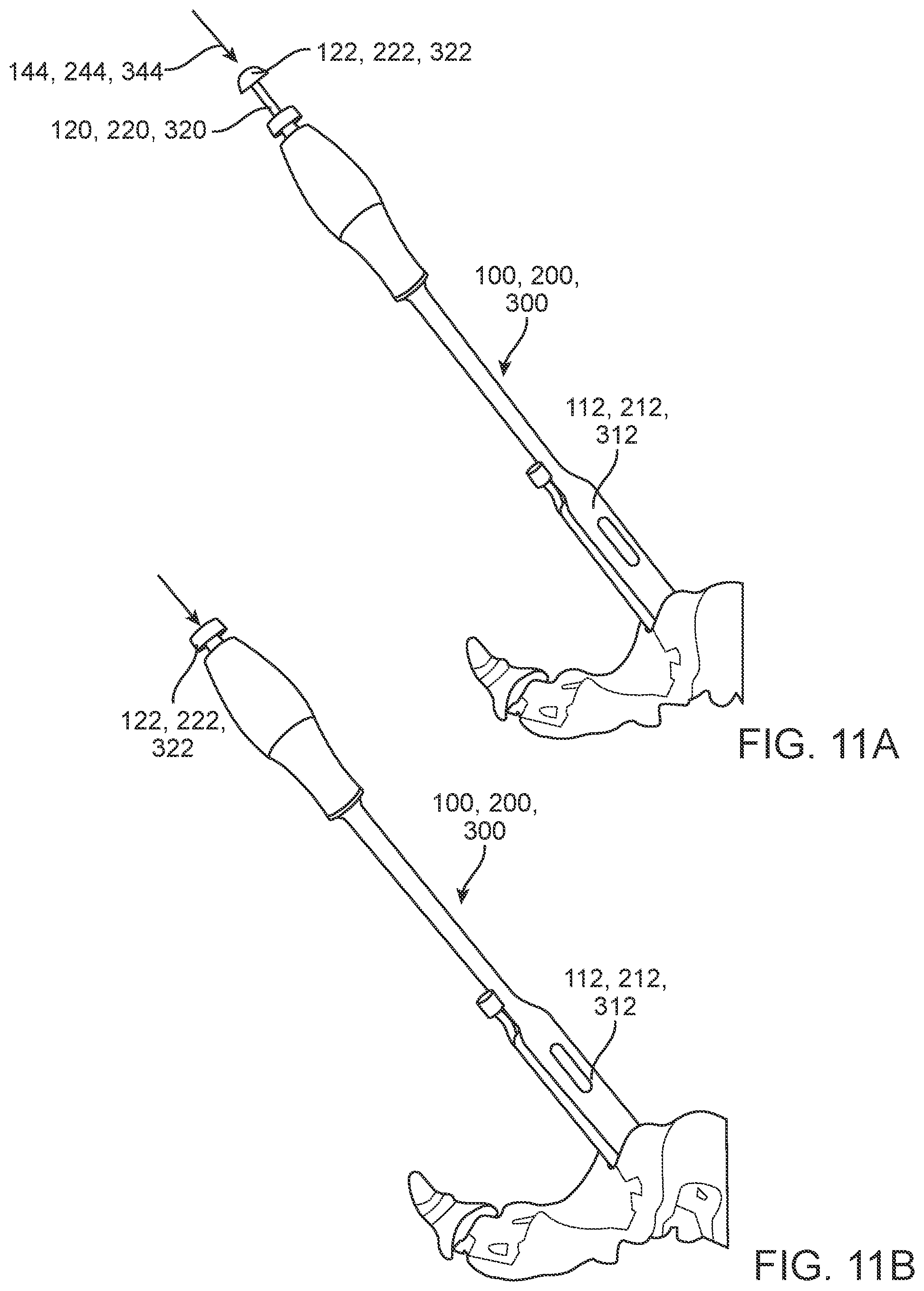Patent US12350174 Figure 9 – Fixation member inserter instrument