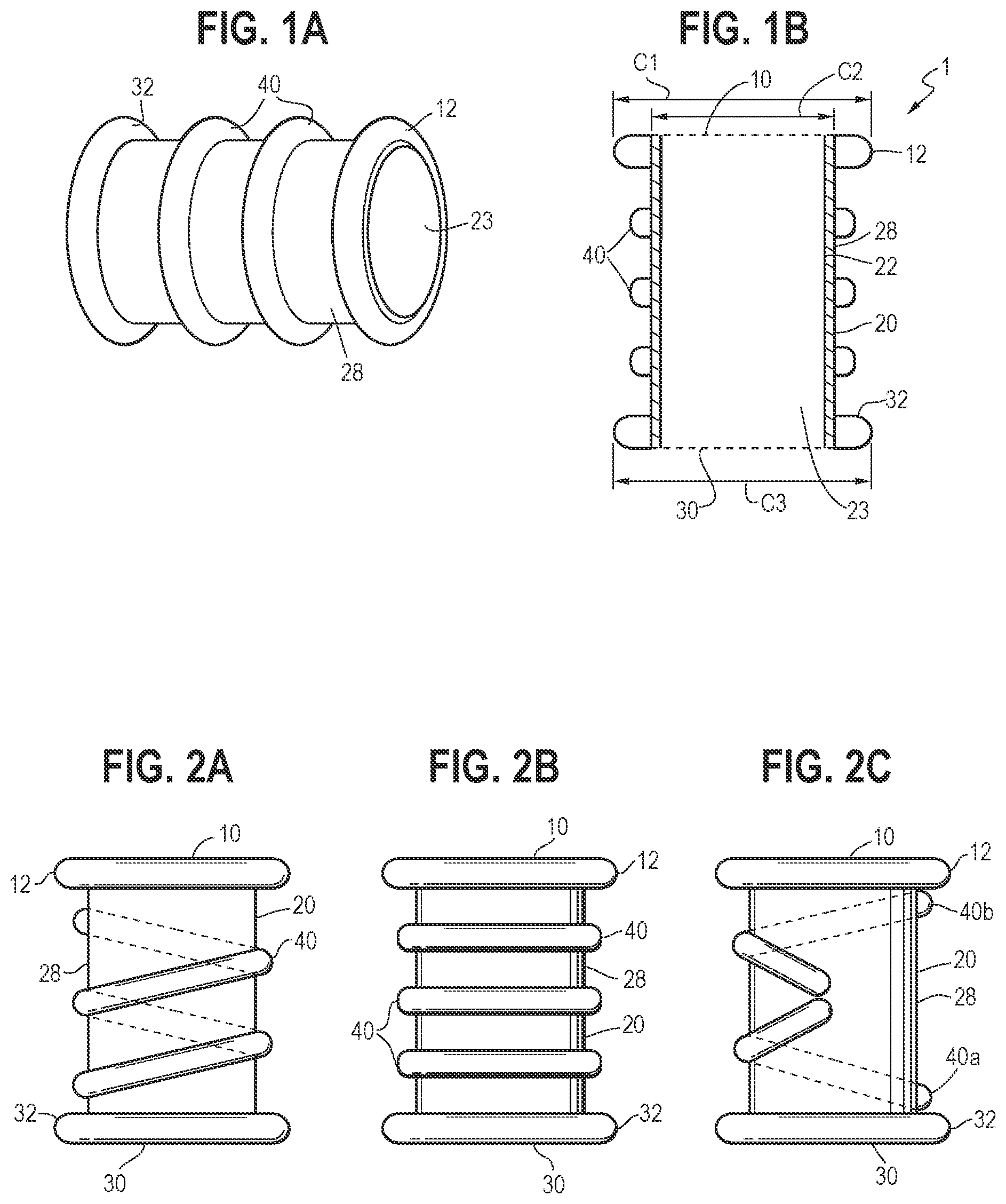 Patent US12350177 Figure 1 – Minimally invasive implantable devices