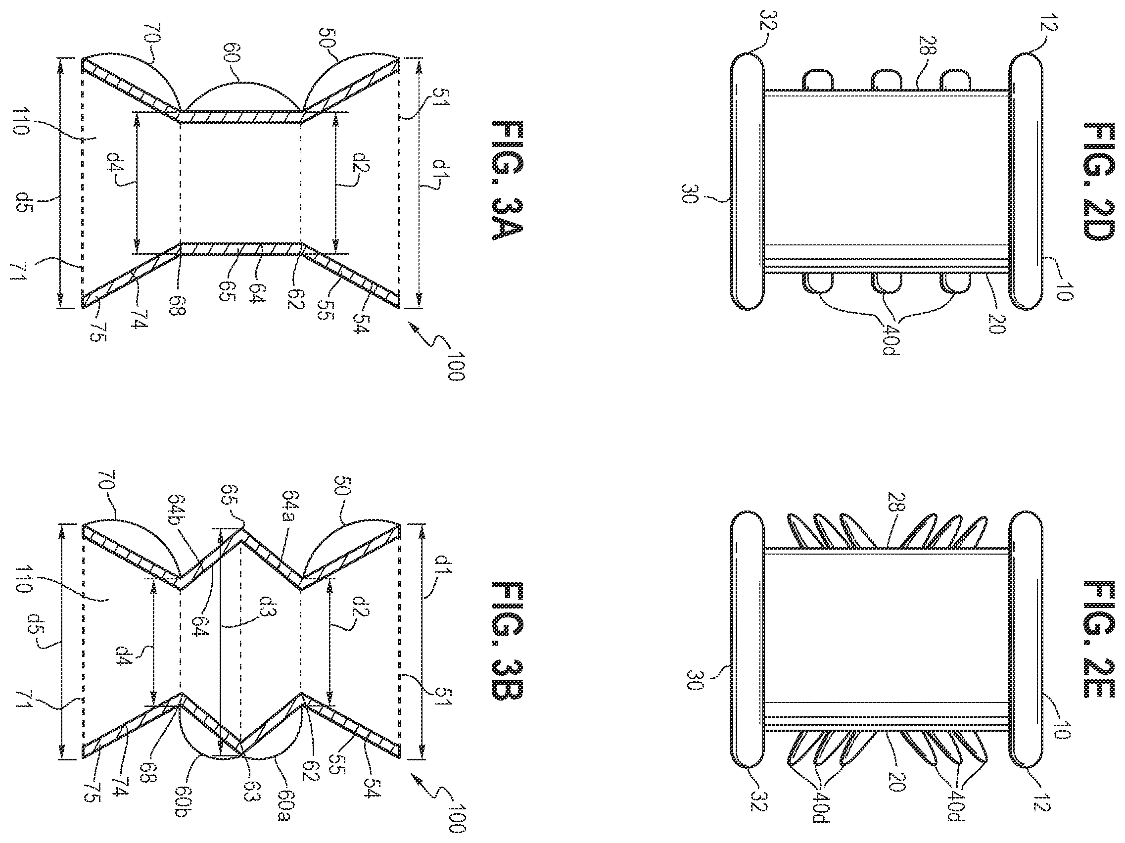 Patent US12350177 Figure 2 – Minimally invasive implantable devices