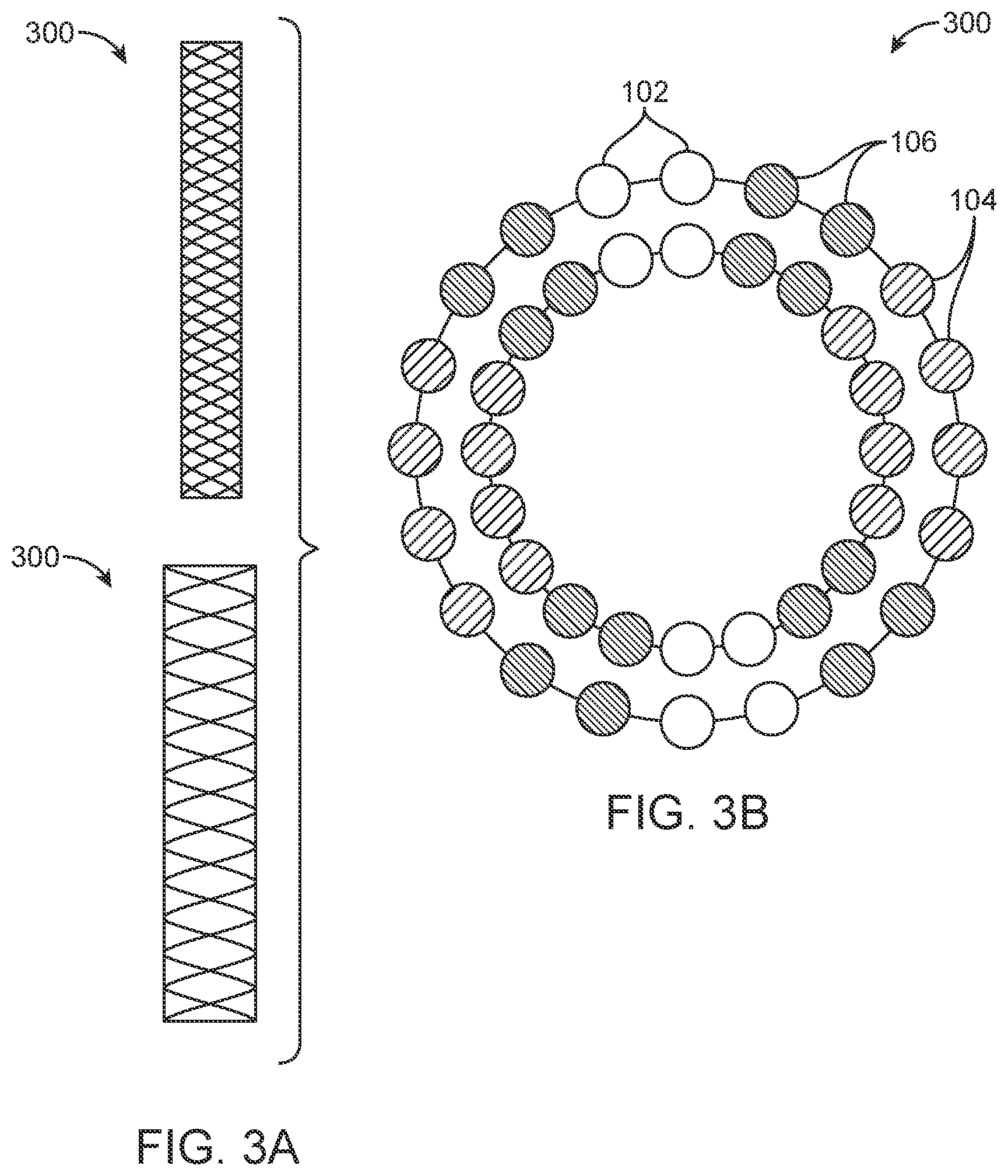 Patent US12350178 Figure 3 – Stent braid pattern with enhanced radiopacity