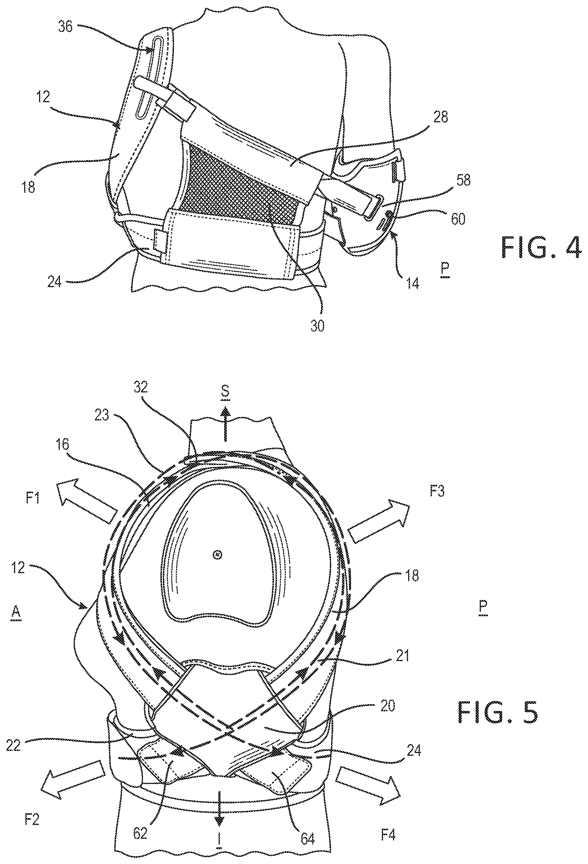 Patent US12350180 Figure 3 – Shoulder immobilizer and arm apparatus