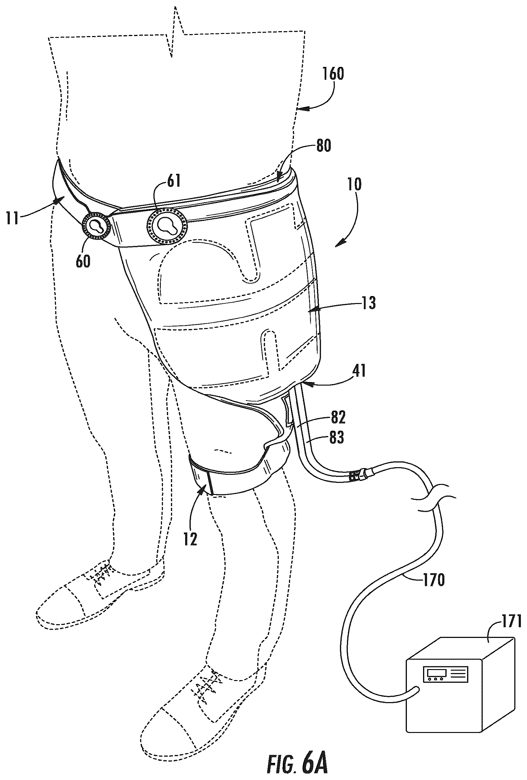 Patent US12350182 Figure 6 – Pain management and post-operative hip orthosis