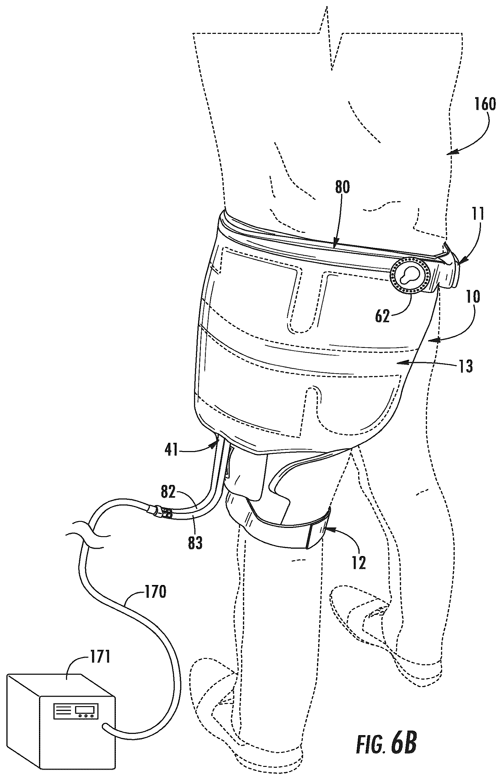Patent US12350182 Figure 7 – Pain management and post-operative hip orthosis