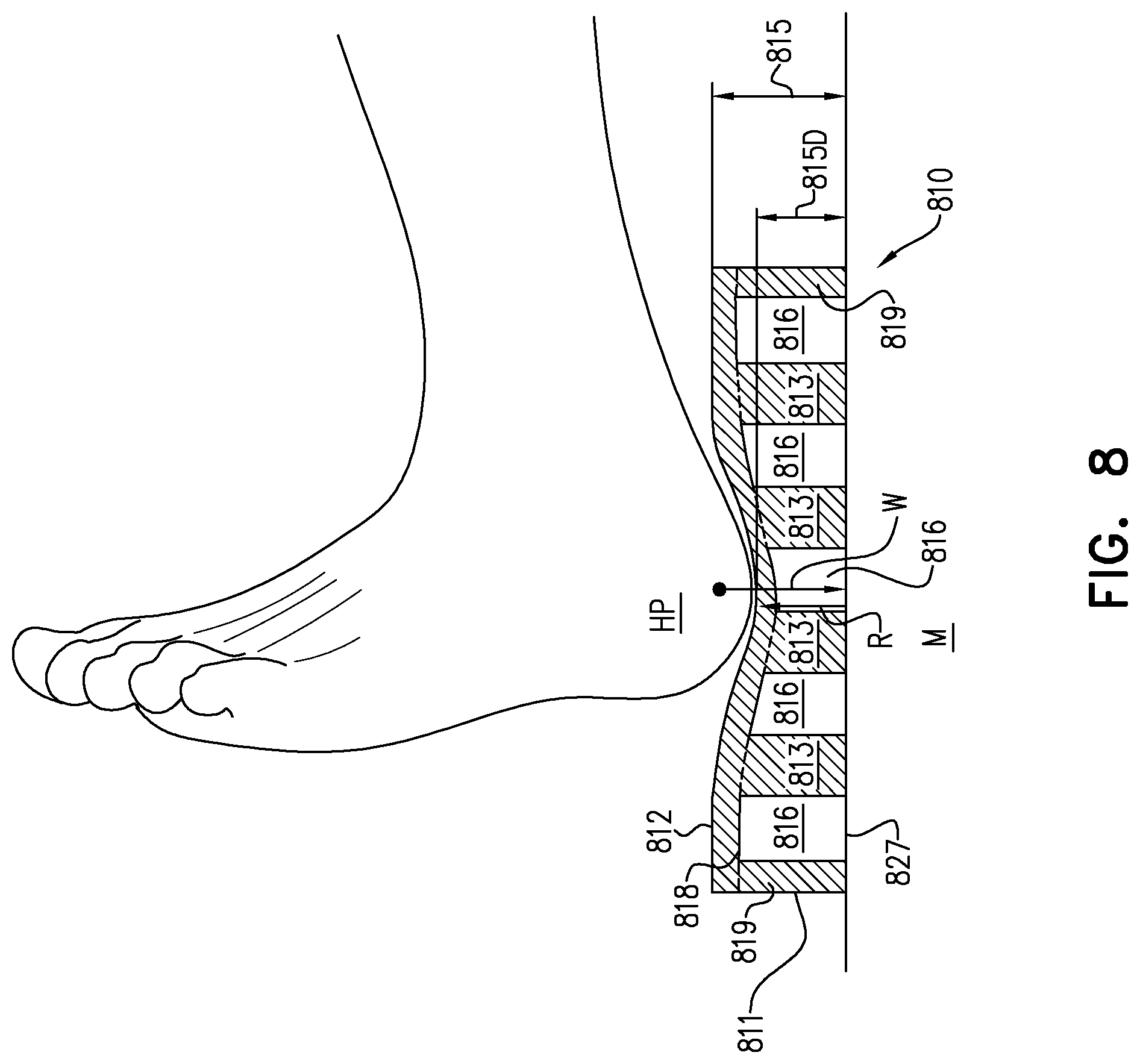 Patent US12350184 Figure 12 – Pressure absorbing skin patch and method of manufacturing same