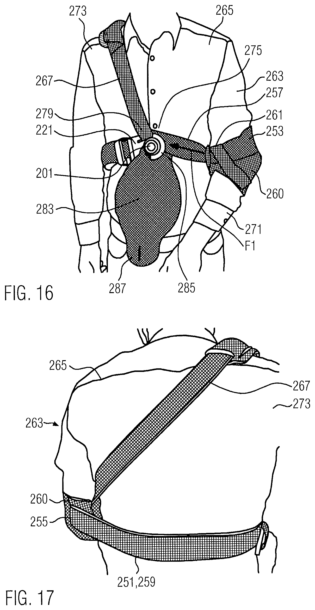 Patent US12350185 Figure 9 – Orthosis for fixing a shoulder joint