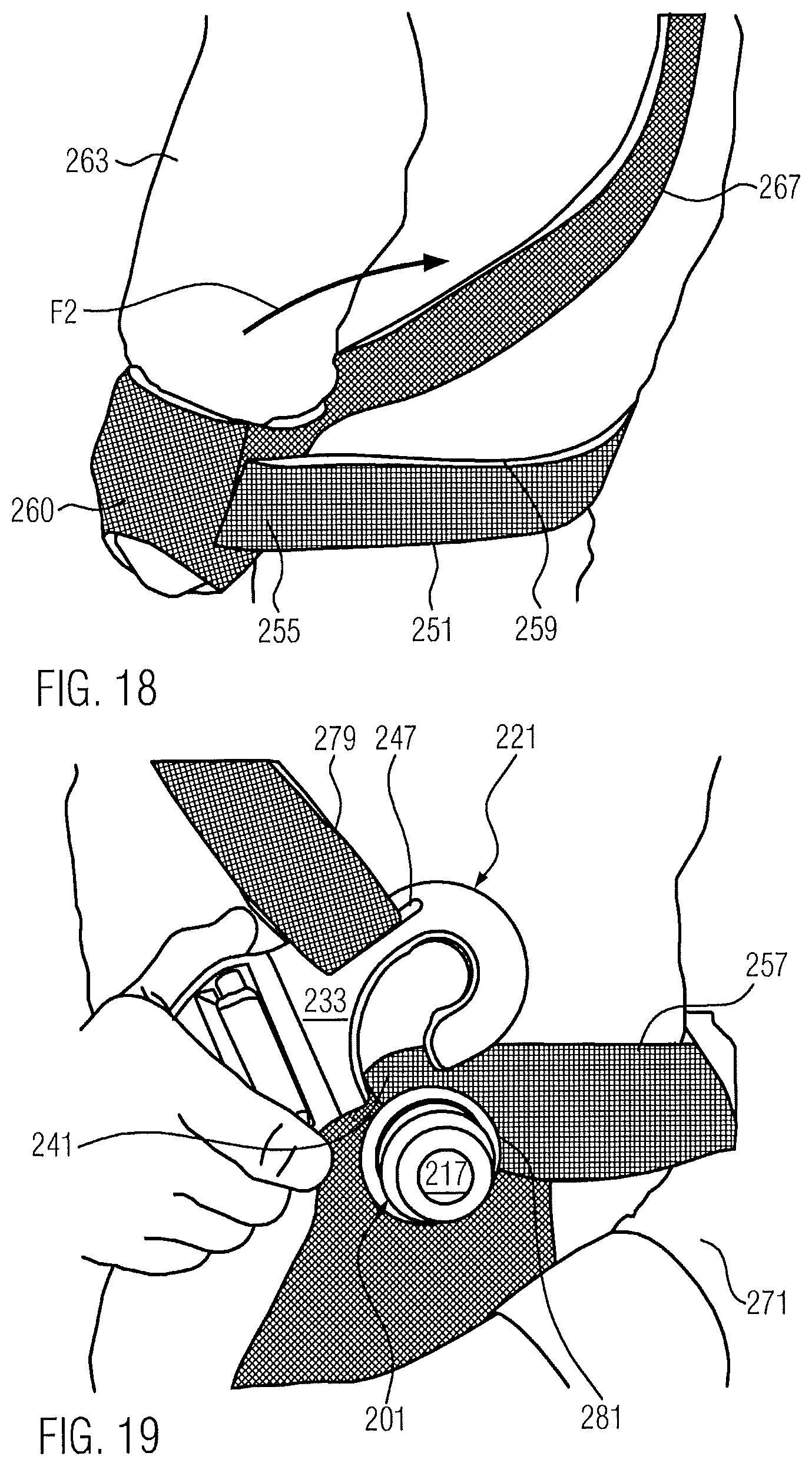 Patent US12350185 Figure 10 – Orthosis for fixing a shoulder joint