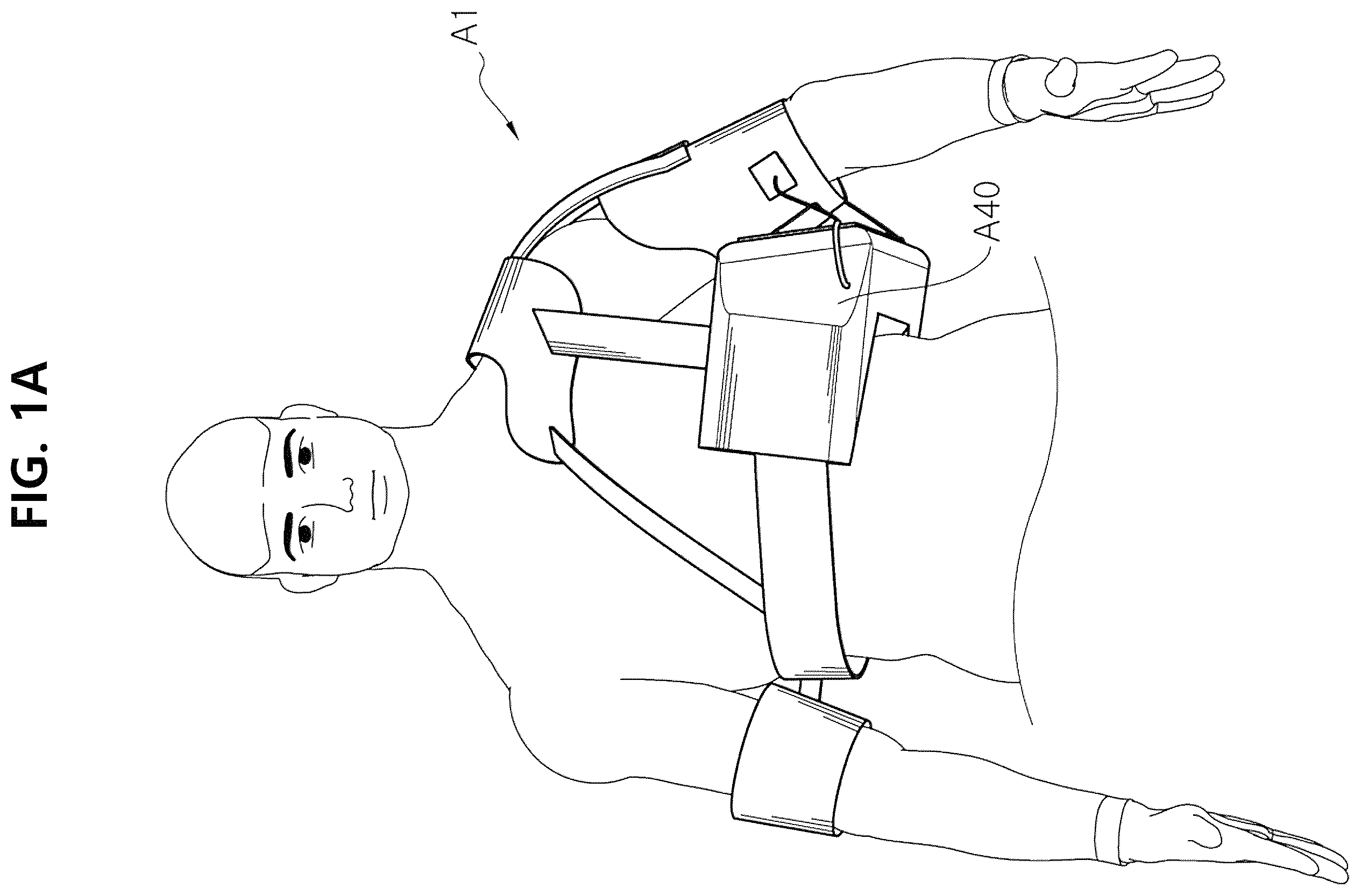 Patent US12350186 Figure 1 – Non-fixed shoulder brace