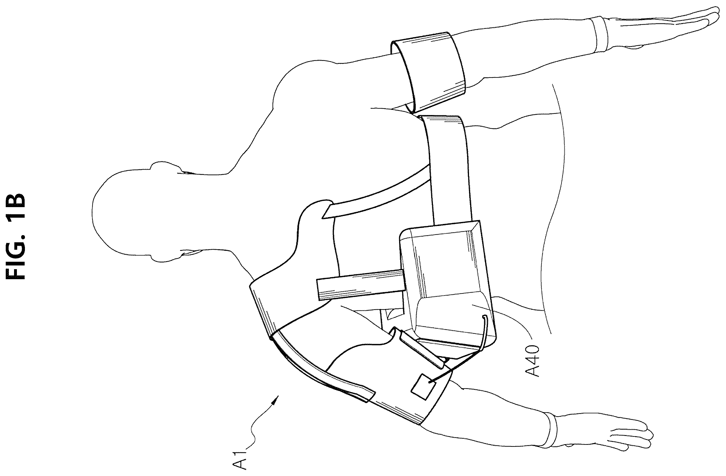 Patent US12350186 Figure 2 – Non-fixed shoulder brace