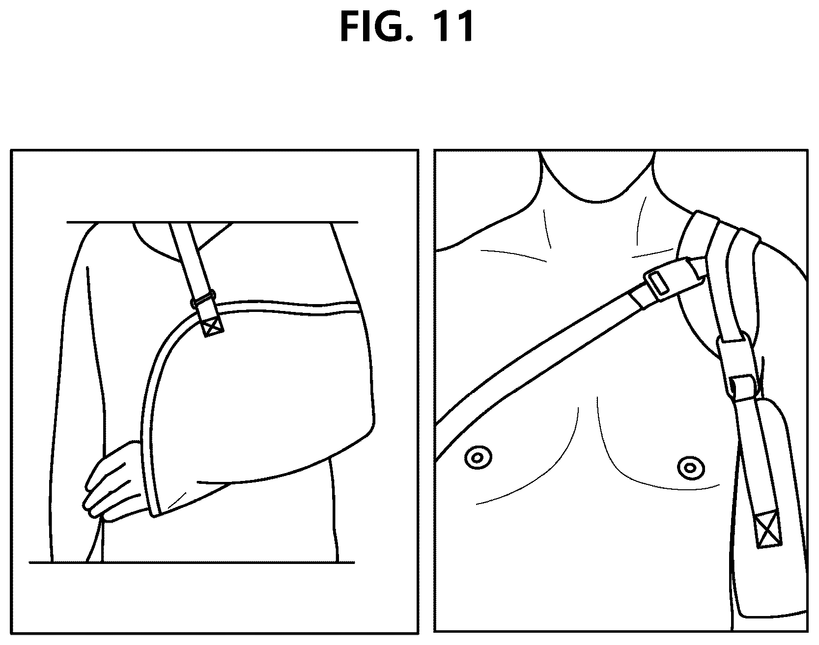 Patent US12350186 Figure 13 – Non-fixed shoulder brace