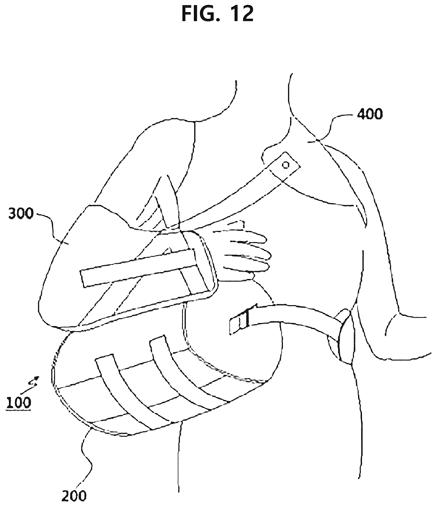 Patent US12350186 Figure 14 – Non-fixed shoulder brace