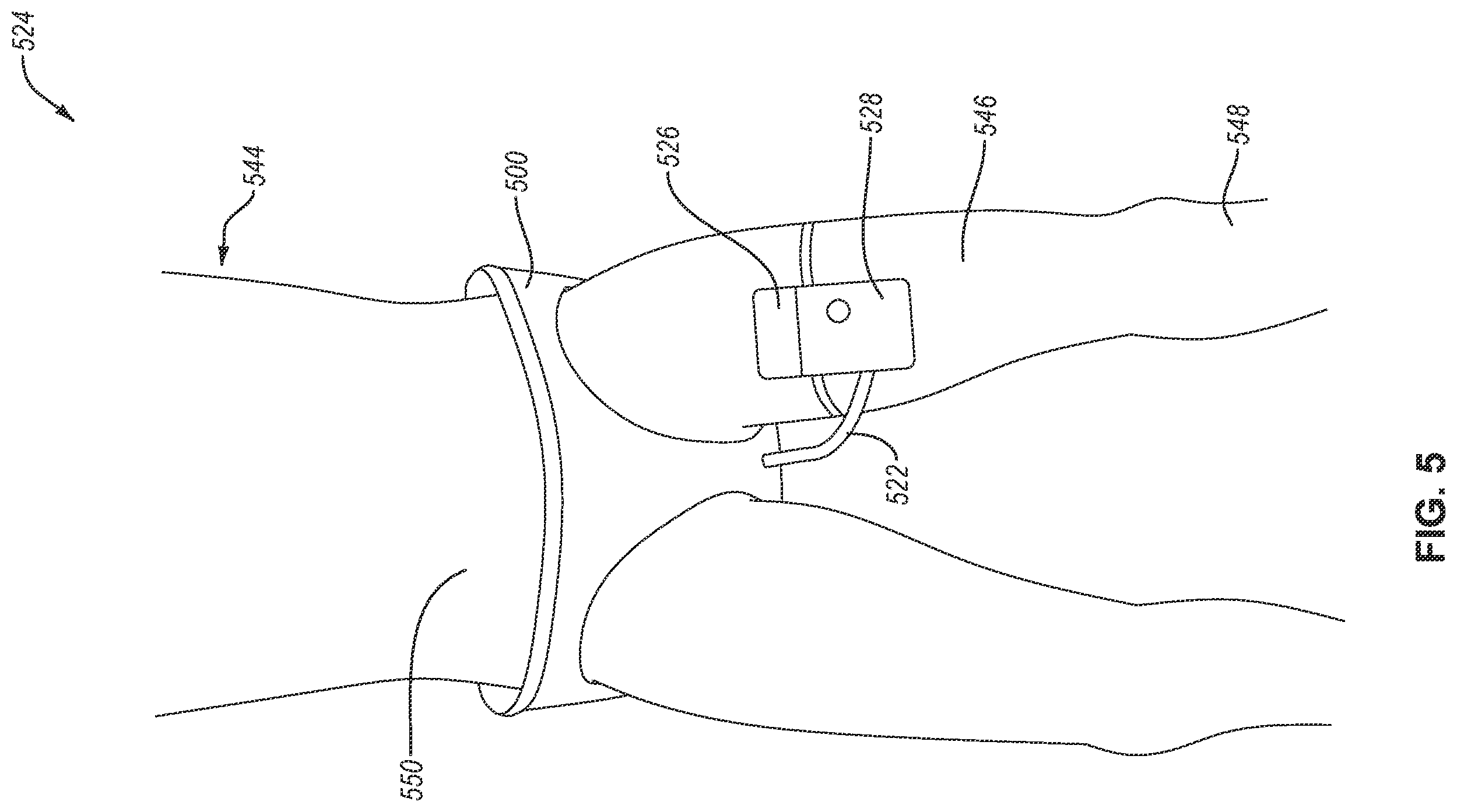 Patent US12350187 Figure 7 – Fluid collection assemblies defining waist and leg openings