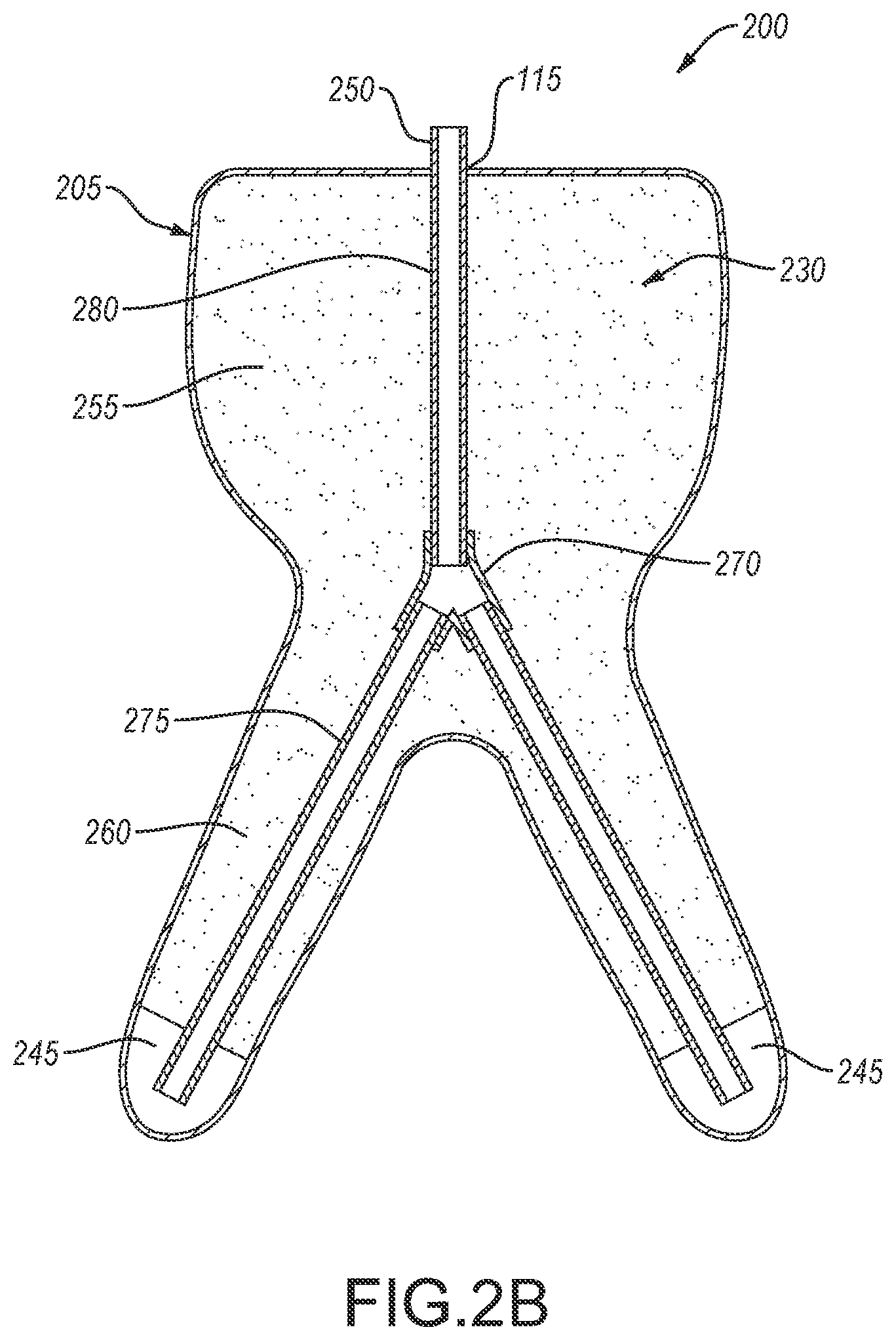 Patent US12350190 Figure 4 – Urine collection devices having a relatively wide portion and an elongated portion and related methods