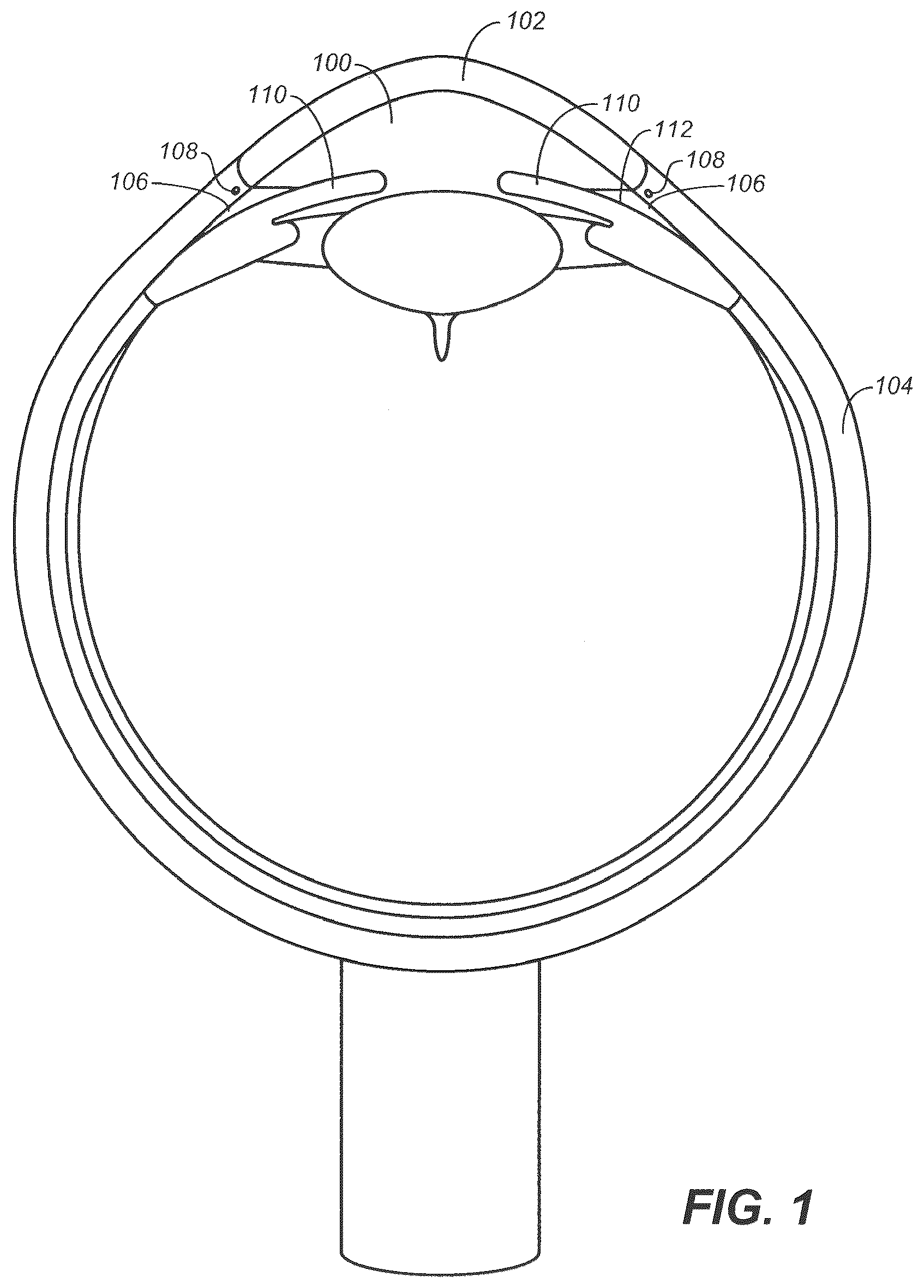 Patent US12350192 Figure 1 – Ocular delivery systems and methods
