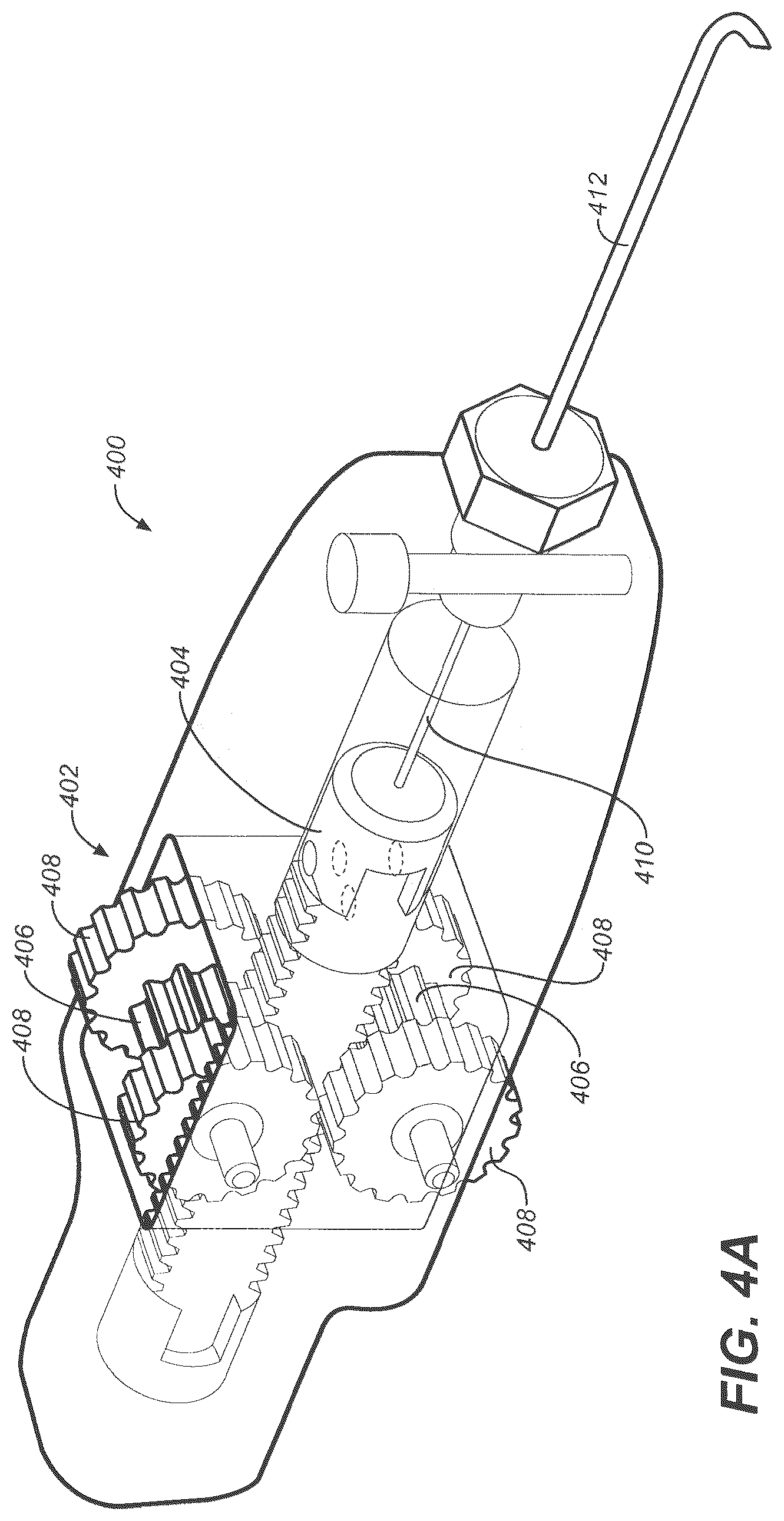 Patent US12350192 Figure 4 – Ocular delivery systems and methods