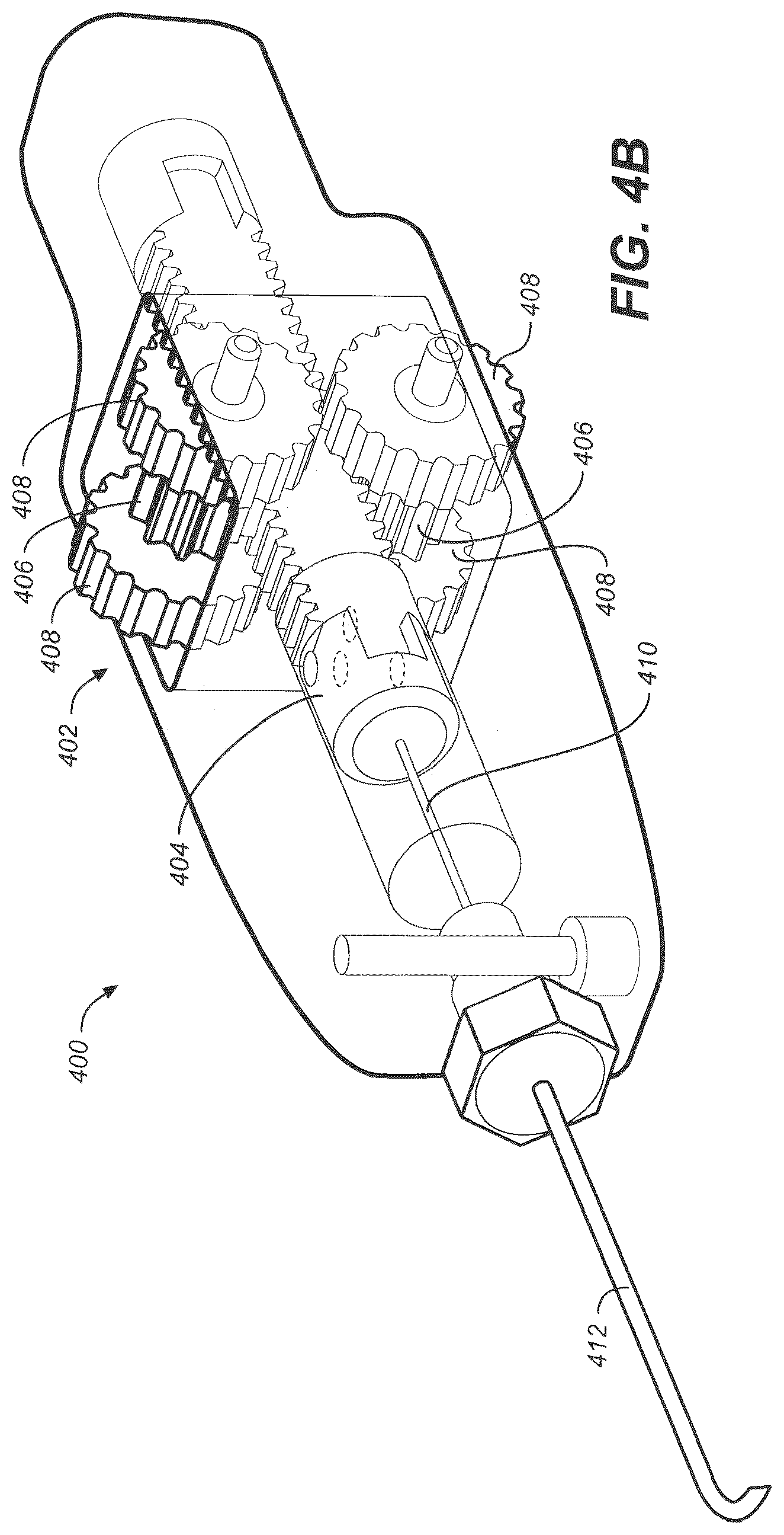 Patent US12350192 Figure 5 – Ocular delivery systems and methods