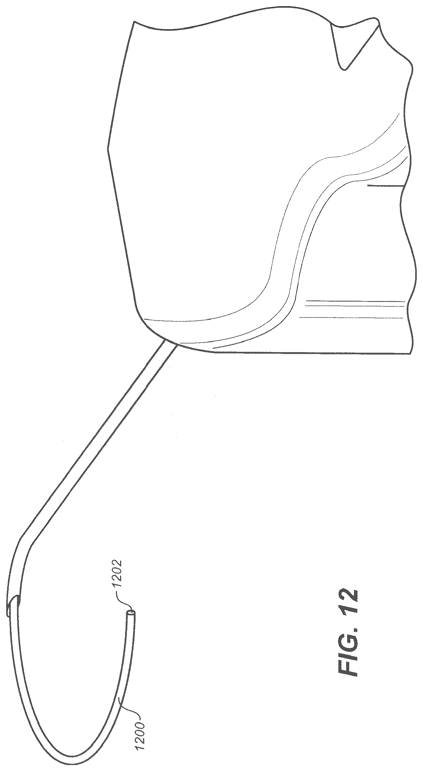 Patent US12350192 Figure 14 – Ocular delivery systems and methods