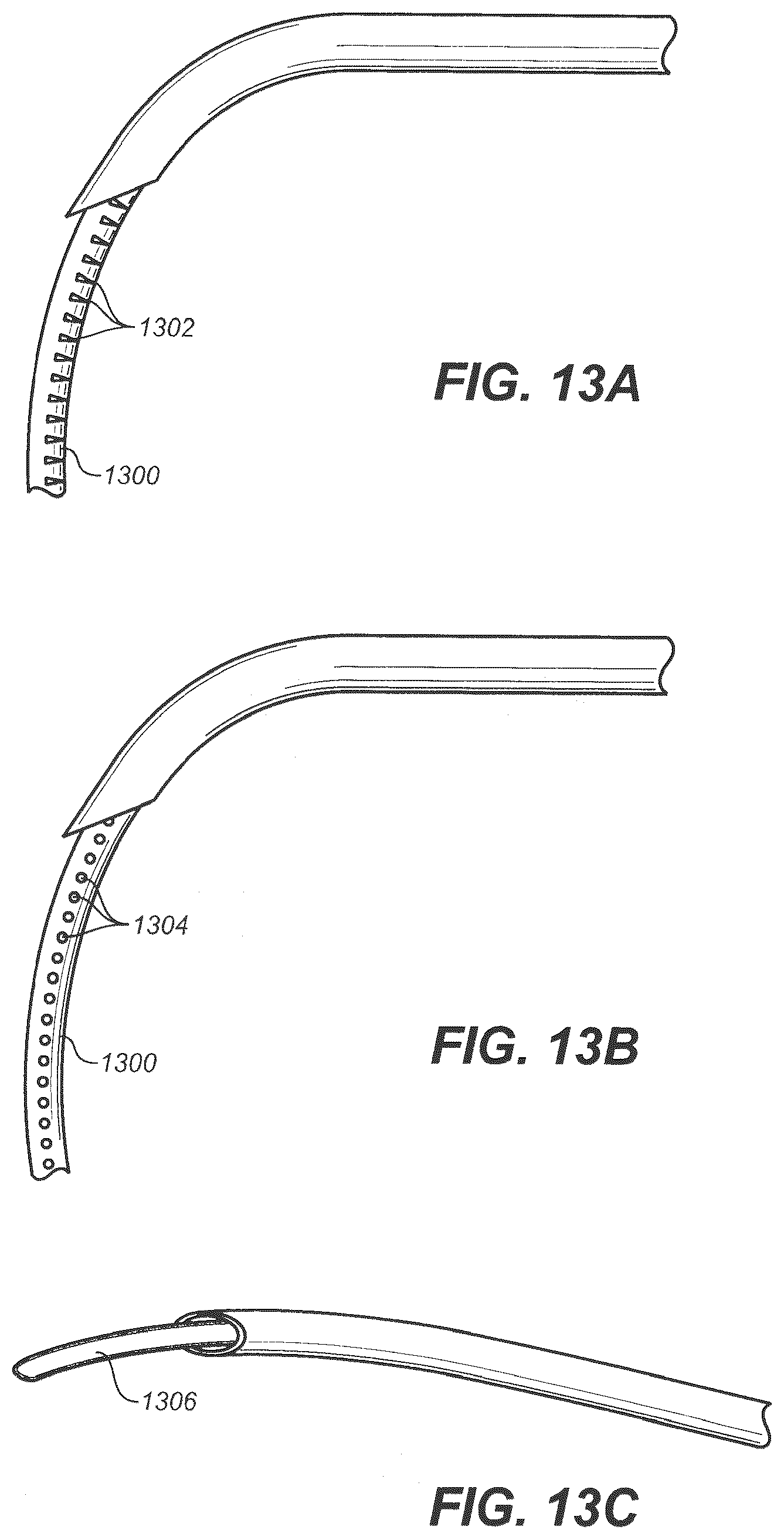 Patent US12350192 Figure 15 – Ocular delivery systems and methods